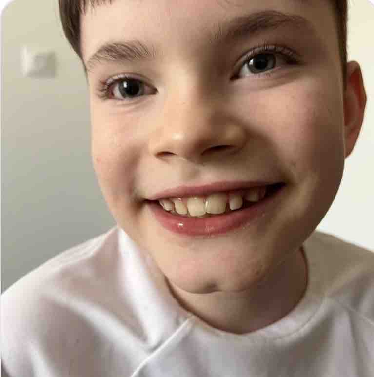Care for Rory campaign photo, 4 of 6