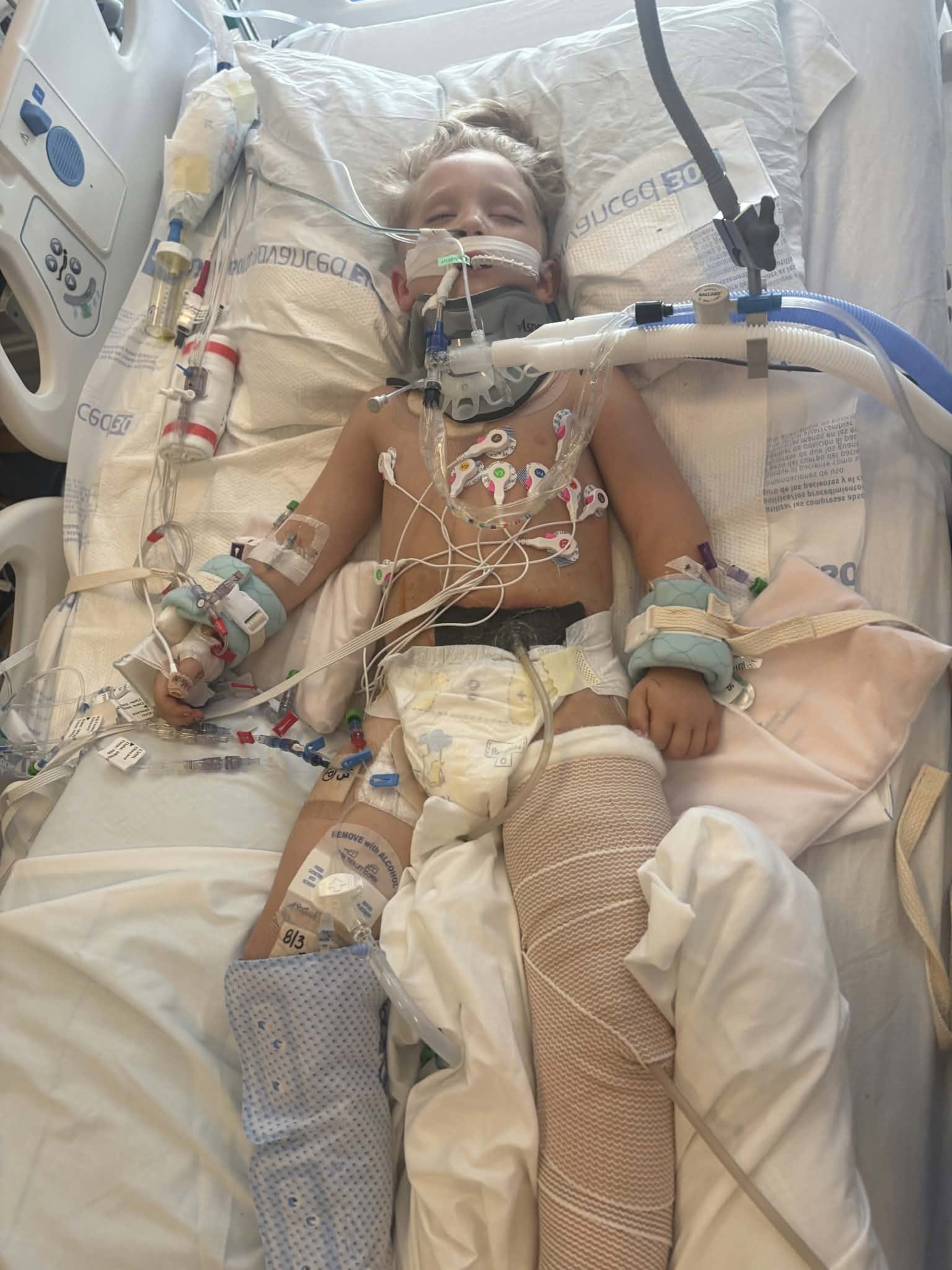 Help Easton Recover from Life-Threatening Injuries campaign photo, 7 of 8