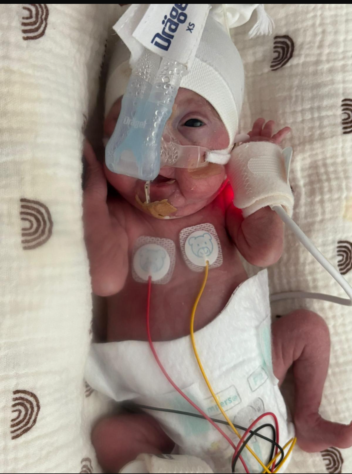 Help us support the Neonatal units that saved our daughter campaign photo, 6 of 7