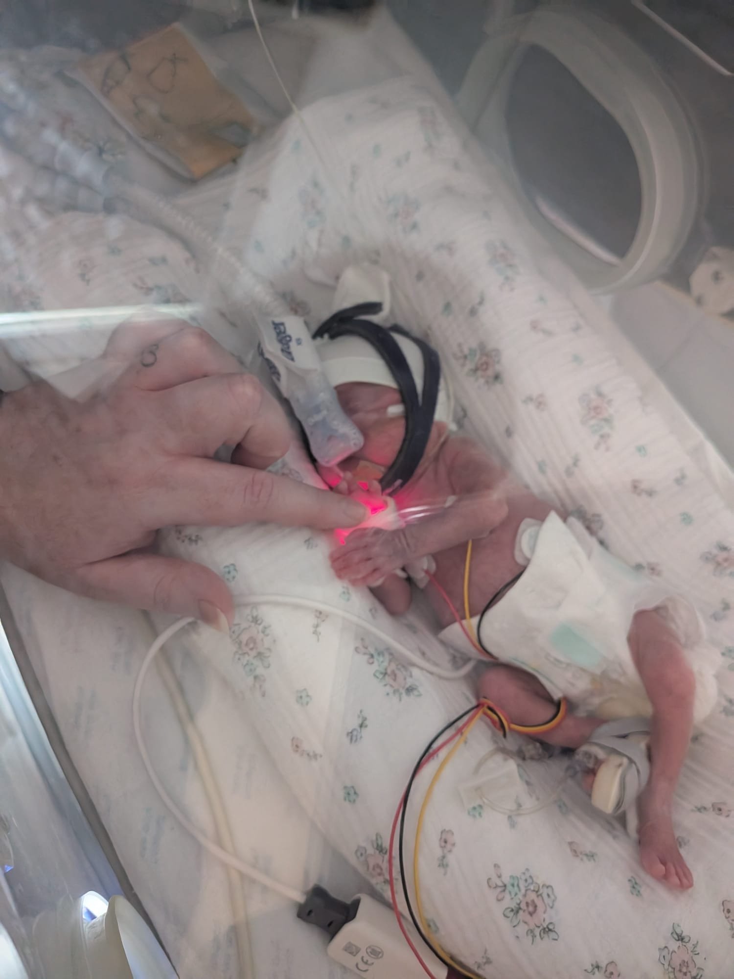 Help us support the Neonatal units that saved our daughter campaign photo, 4 of 7