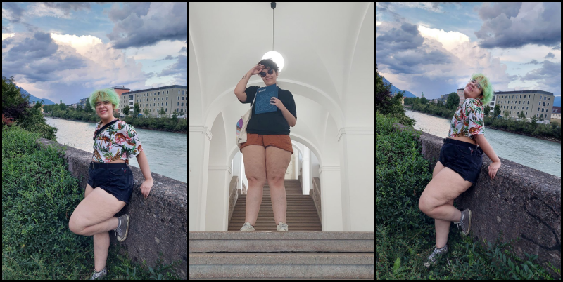 help me afford my lipedema surgery✨ campaign photo, 2 of 4