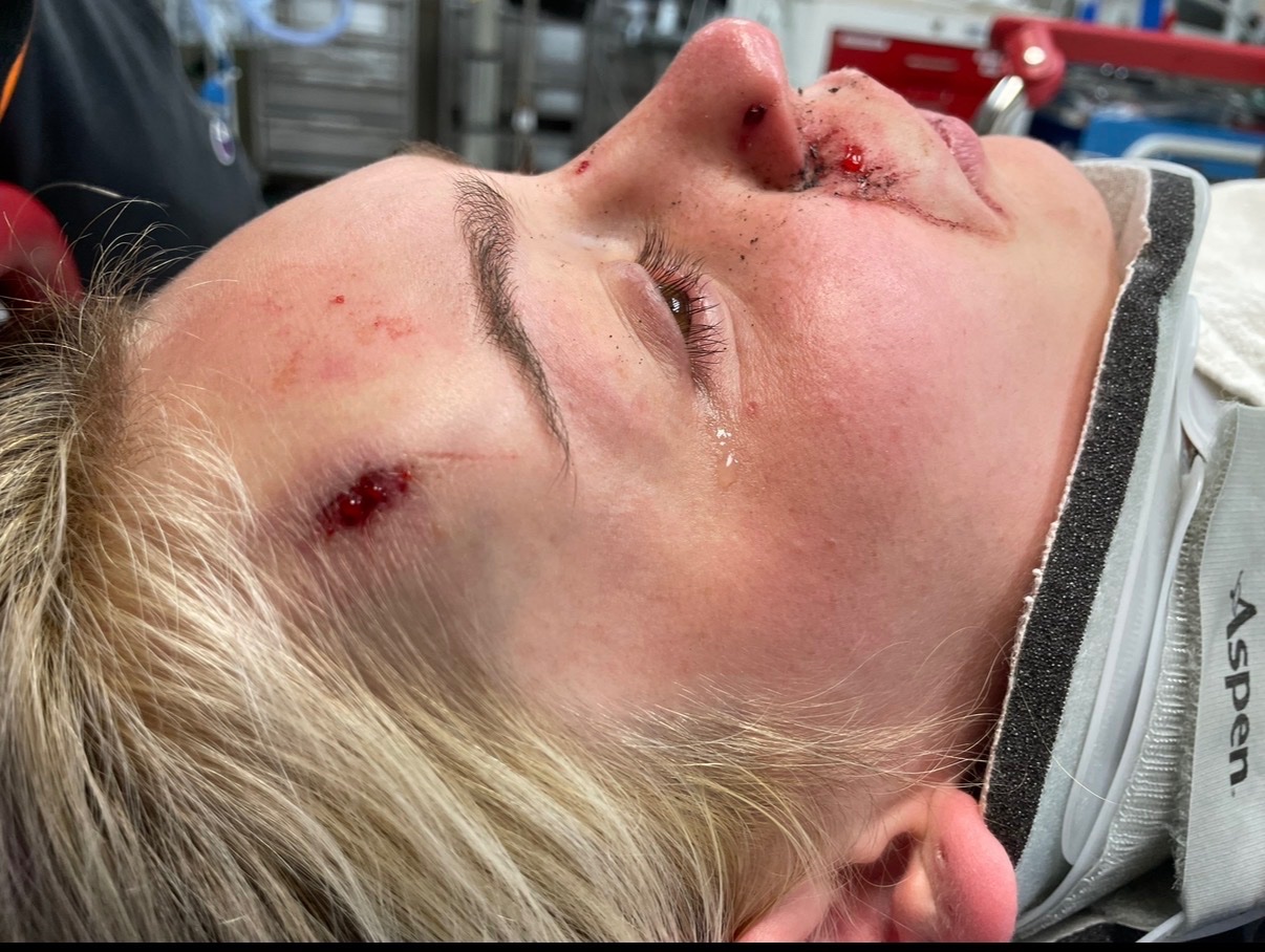 Mallorie's Jaw Surgery and Dental Repair campaign photo, 6 of 7