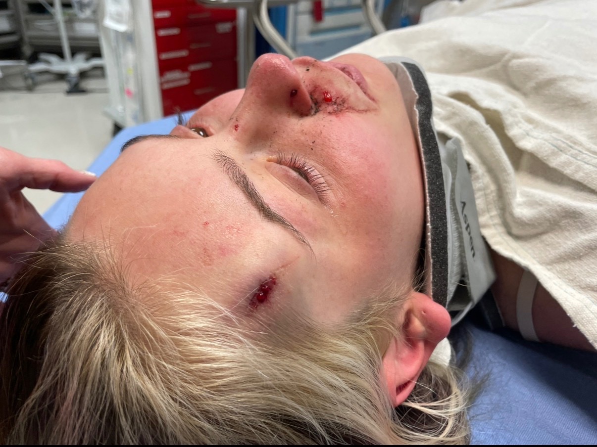 Mallorie's Jaw Surgery and Dental Repair campaign photo, 2 of 7