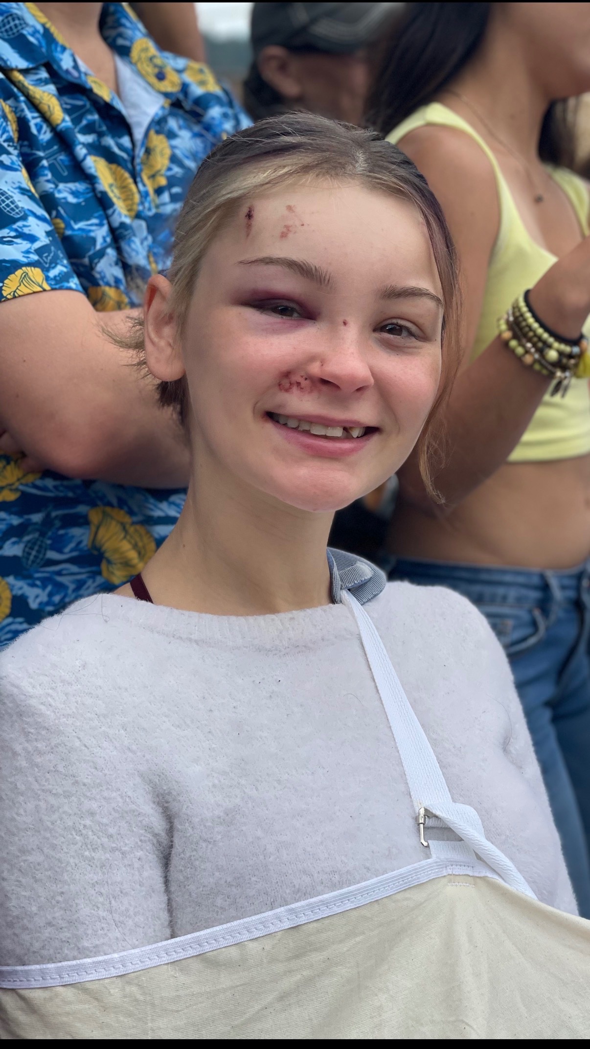 Mallorie's Jaw Surgery and Dental Repair campaign photo, 5 of 7