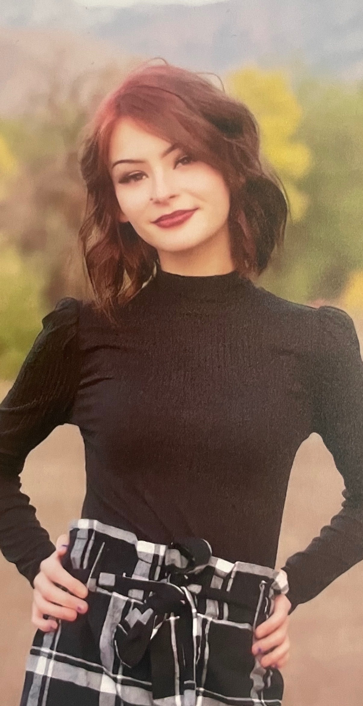Mallorie's Jaw Surgery and Dental Repair campaign photo, 4 of 7