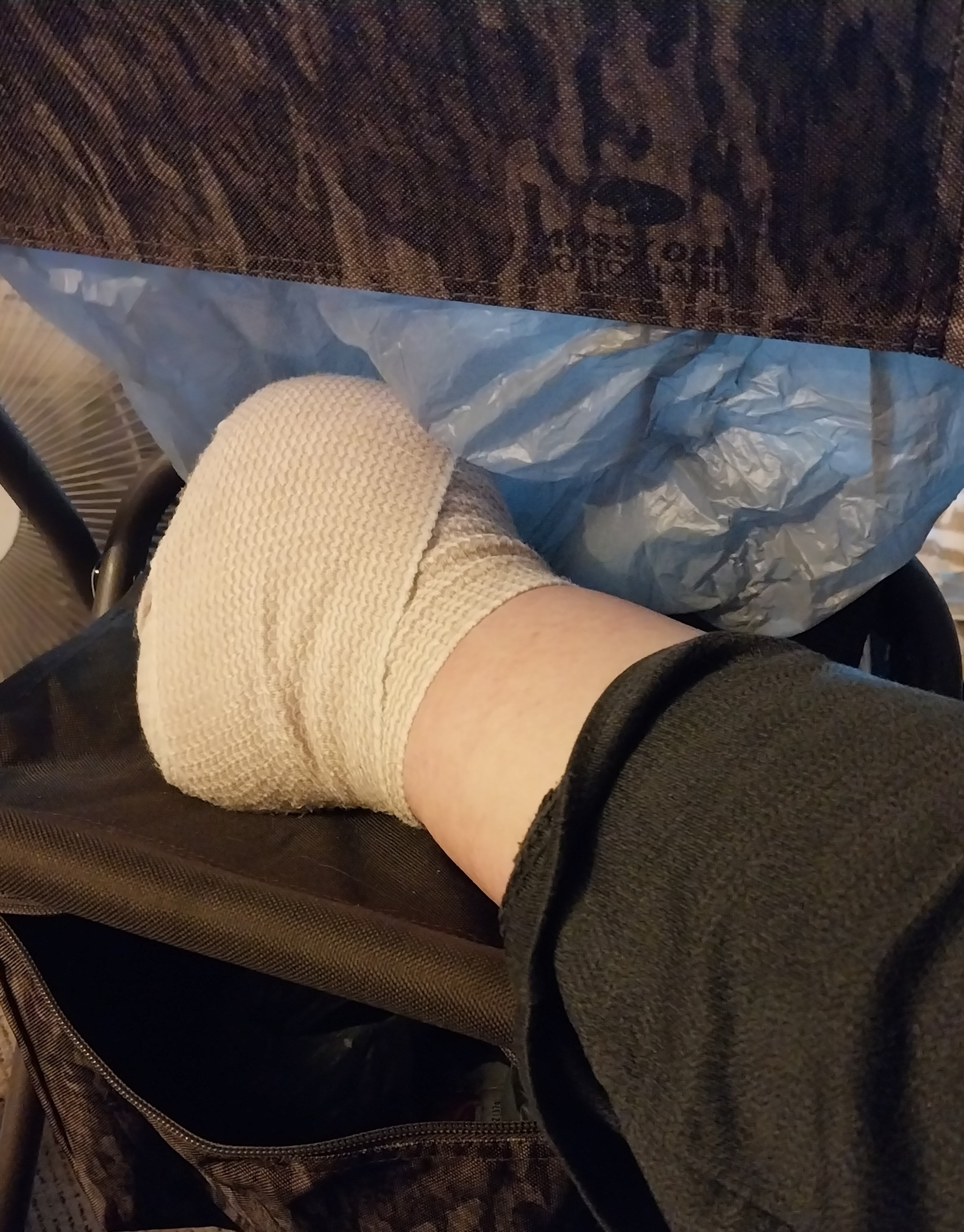 Help Mike with his Foot Surgery Recovery and Aftercare campaign photo, 5 of 6