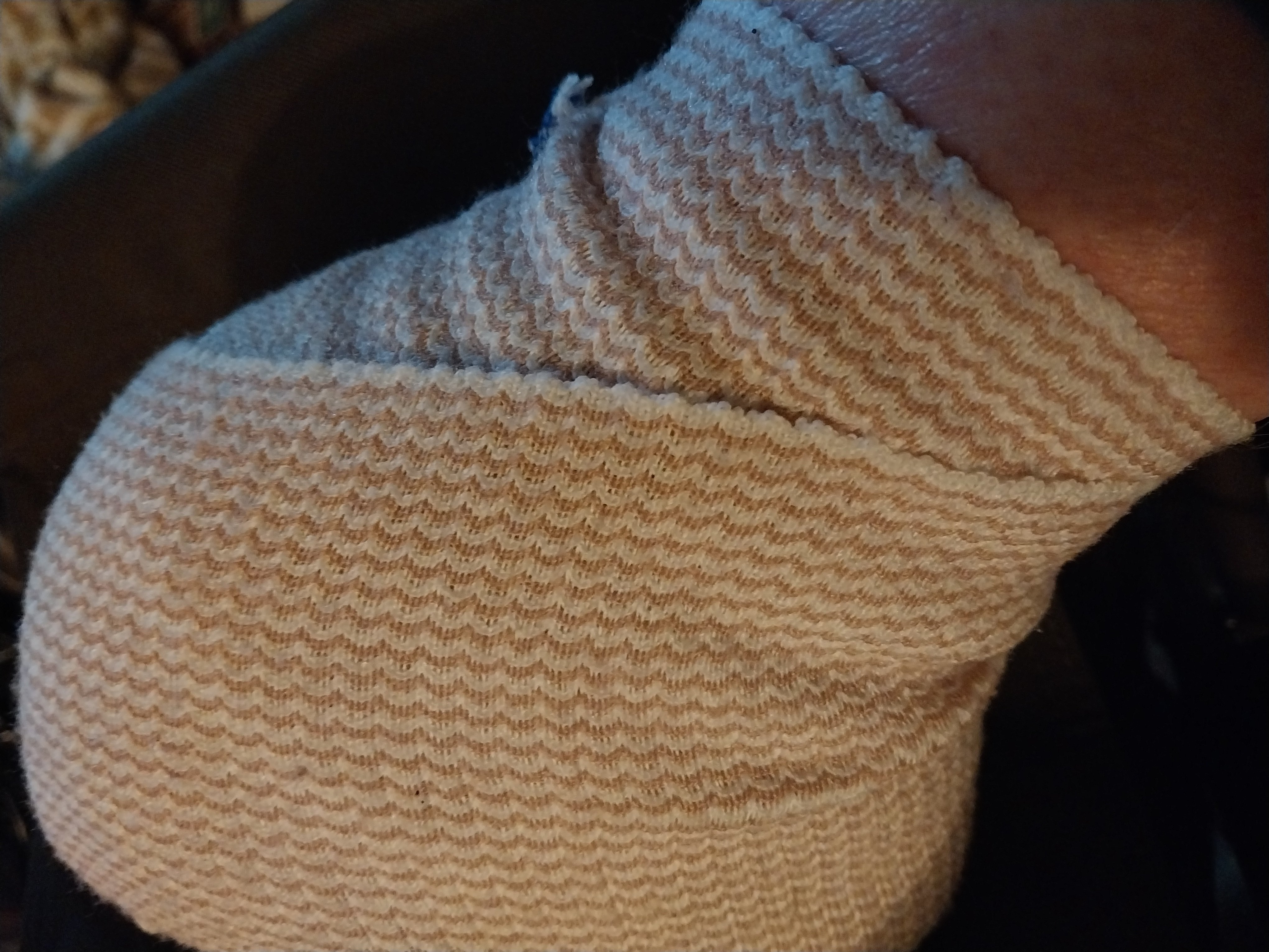 Help Mike with his Foot Surgery Recovery and Aftercare campaign photo, 2 of 6