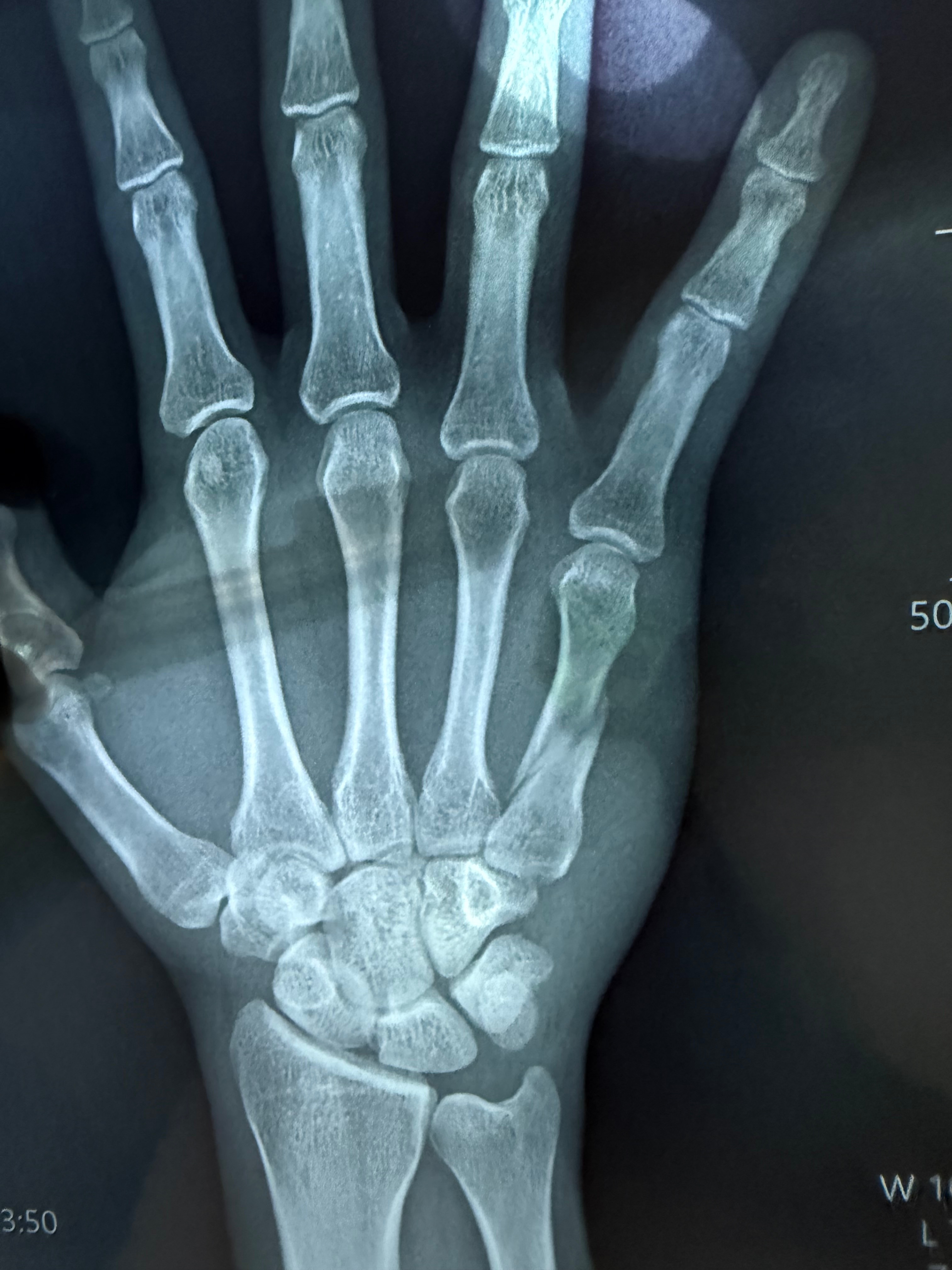 Broken paw & bone and plate implants . campaign photo, 6 of 7
