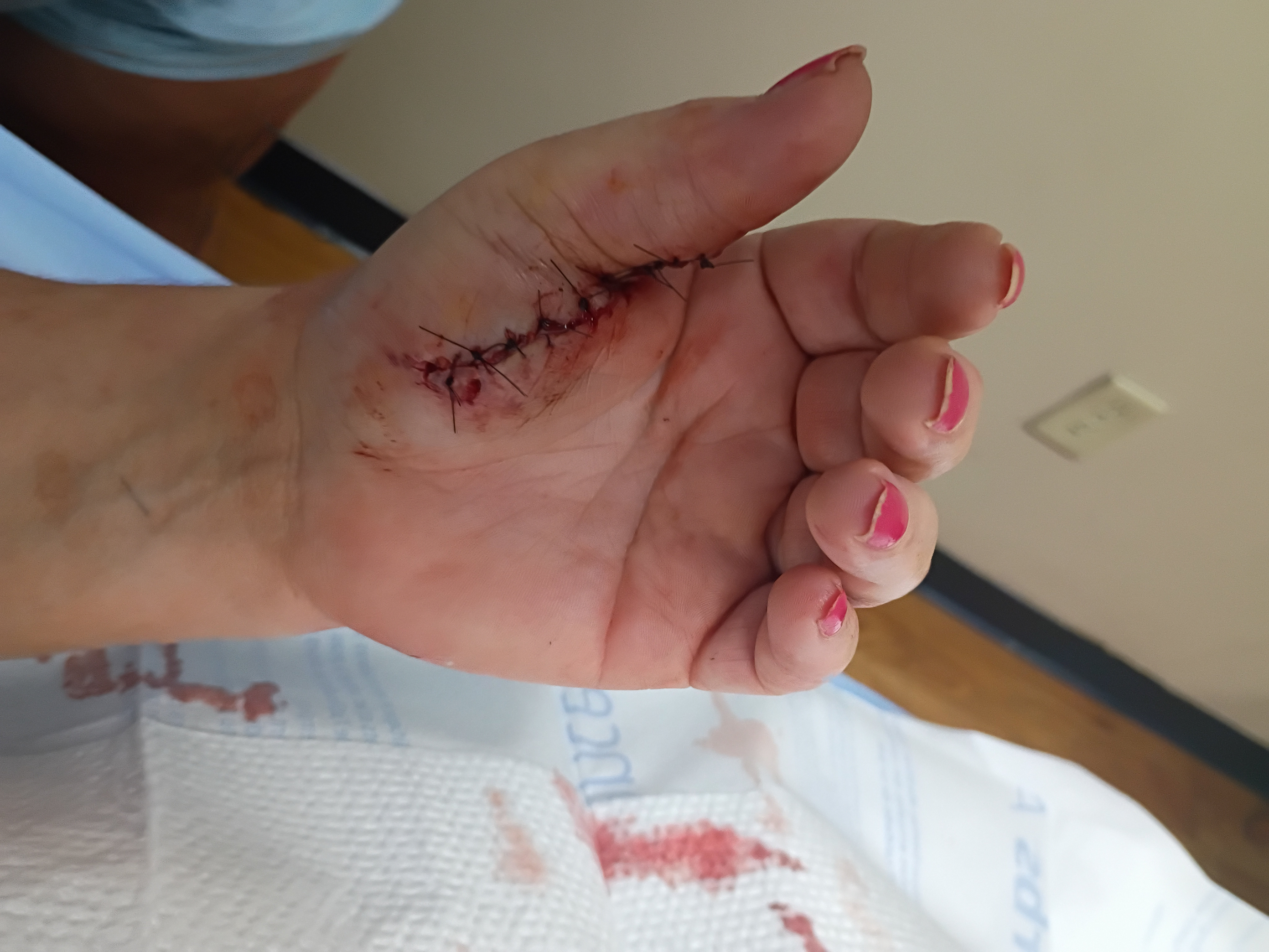 Supporting Angie While Recovering From Dog Attack campaign photo, 2 of 5