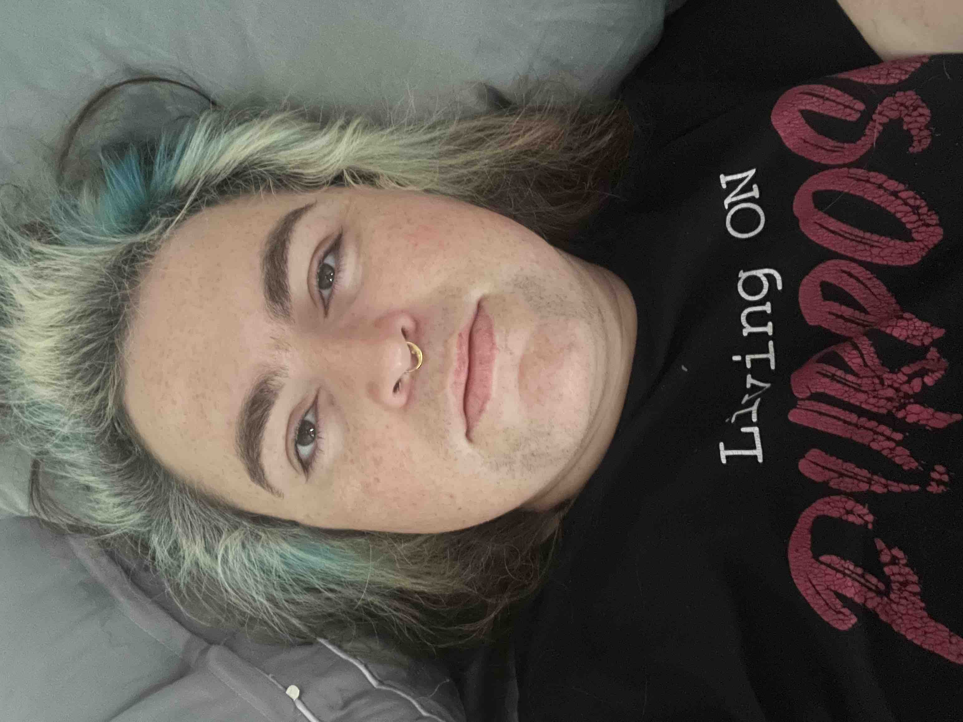Support Mae’s Recovery After Surgery campaign photo, 4 of 5