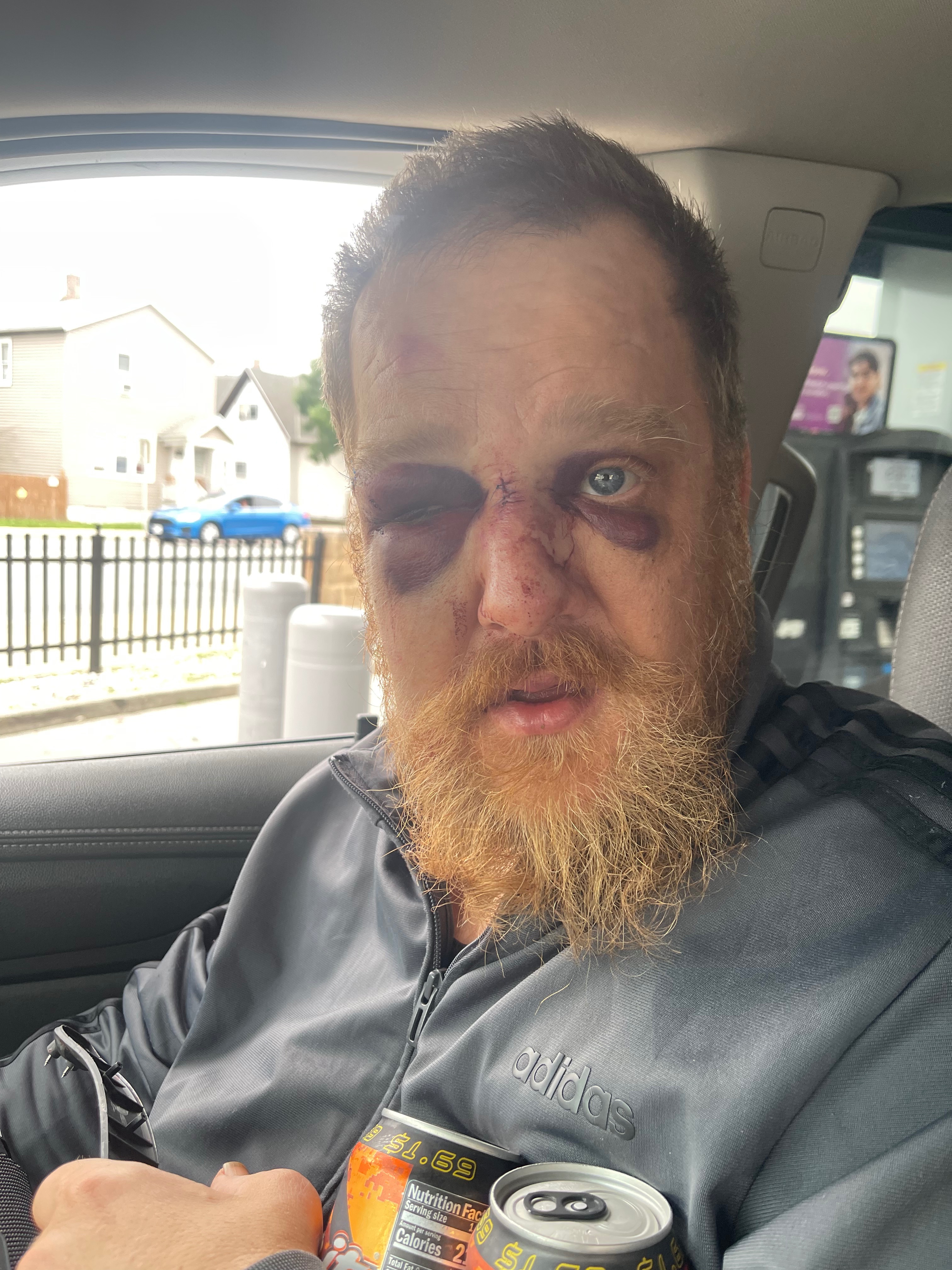 Support Larry’s Recovery After the Attack campaign photo, 2 of 5