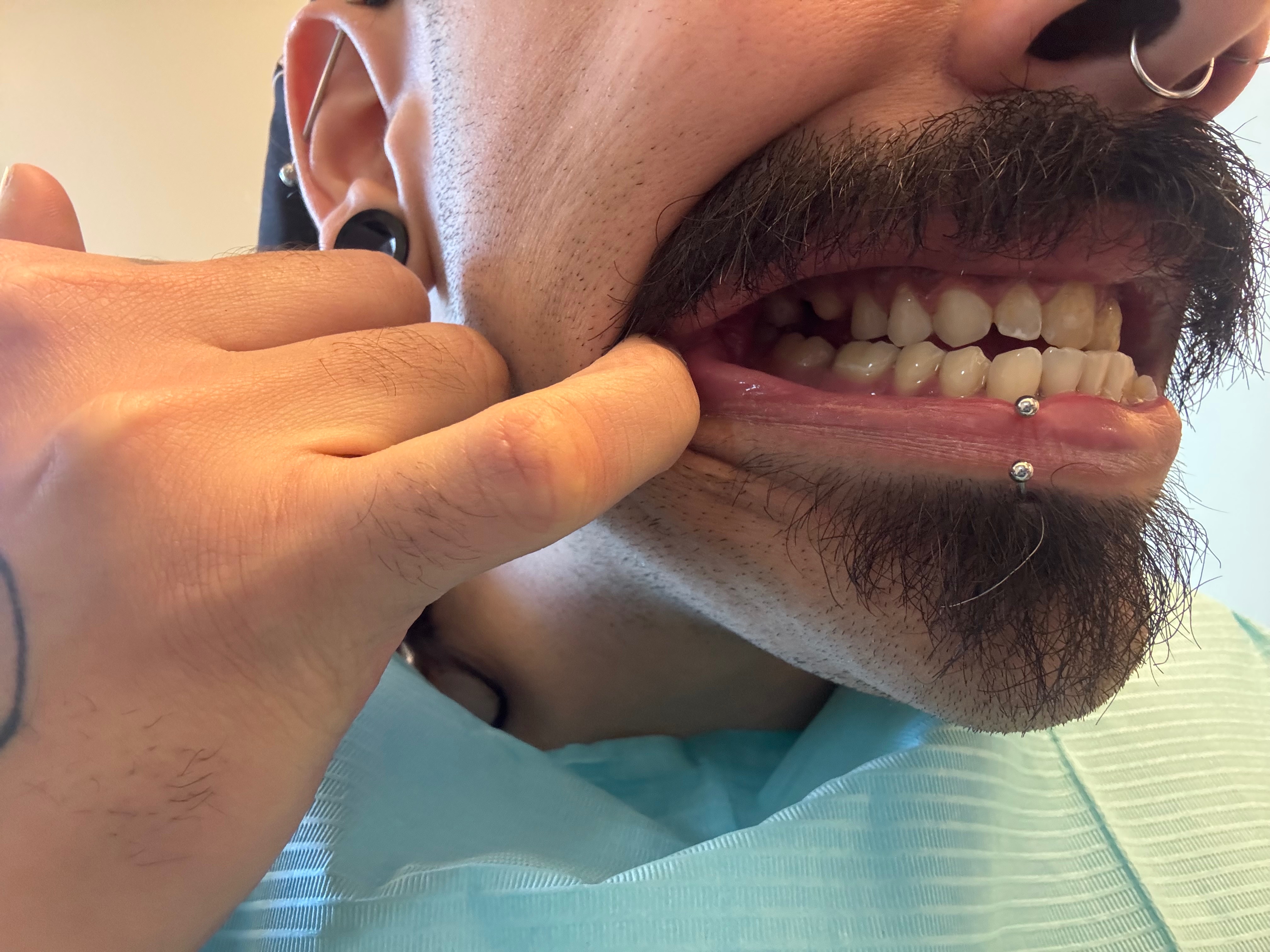 Help Brian With Urgent Dental Care campaign photo, 2 of 6