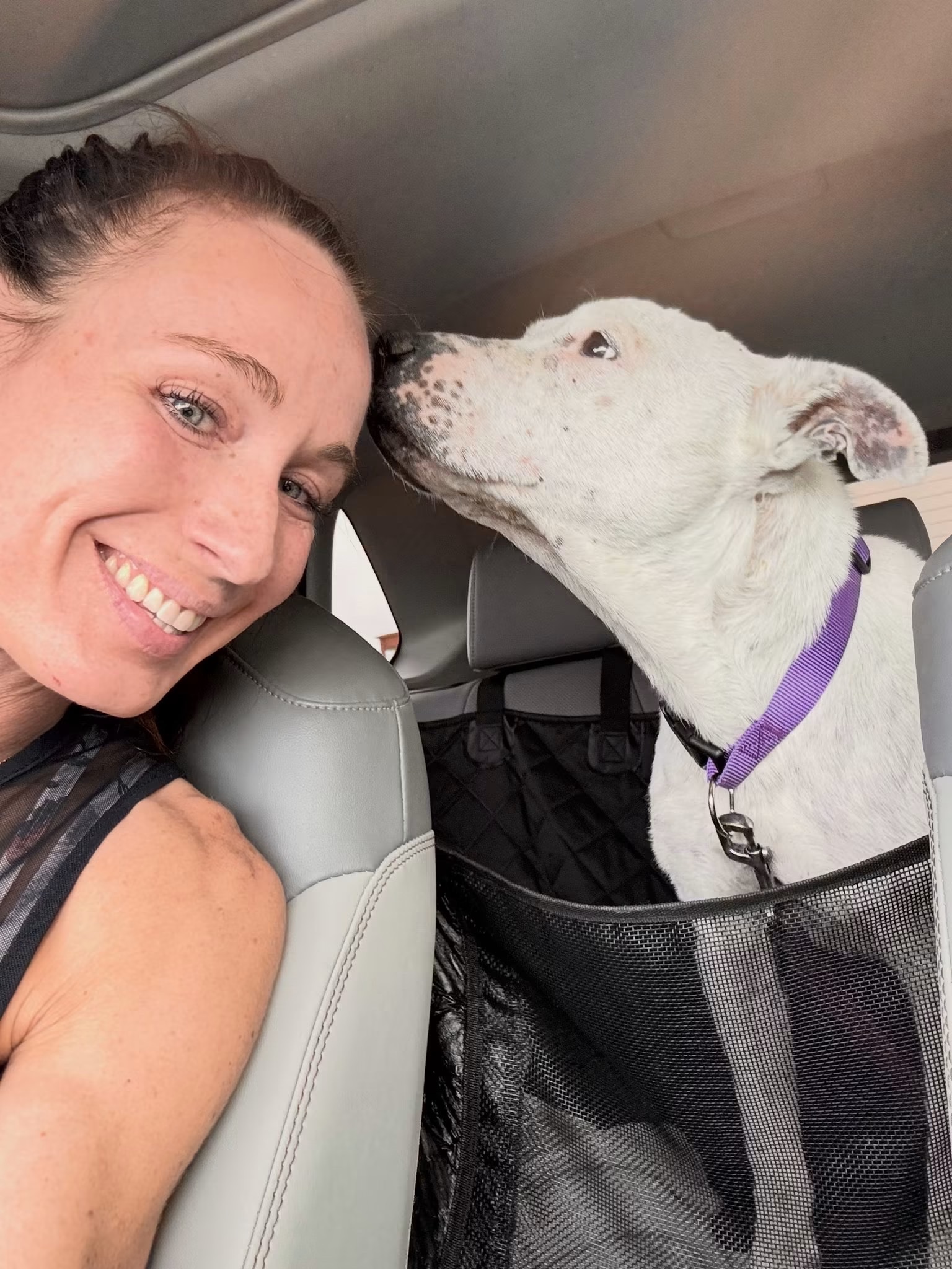 Help Liz Rebuild After a Dog Attack campaign photo, 2 of 6