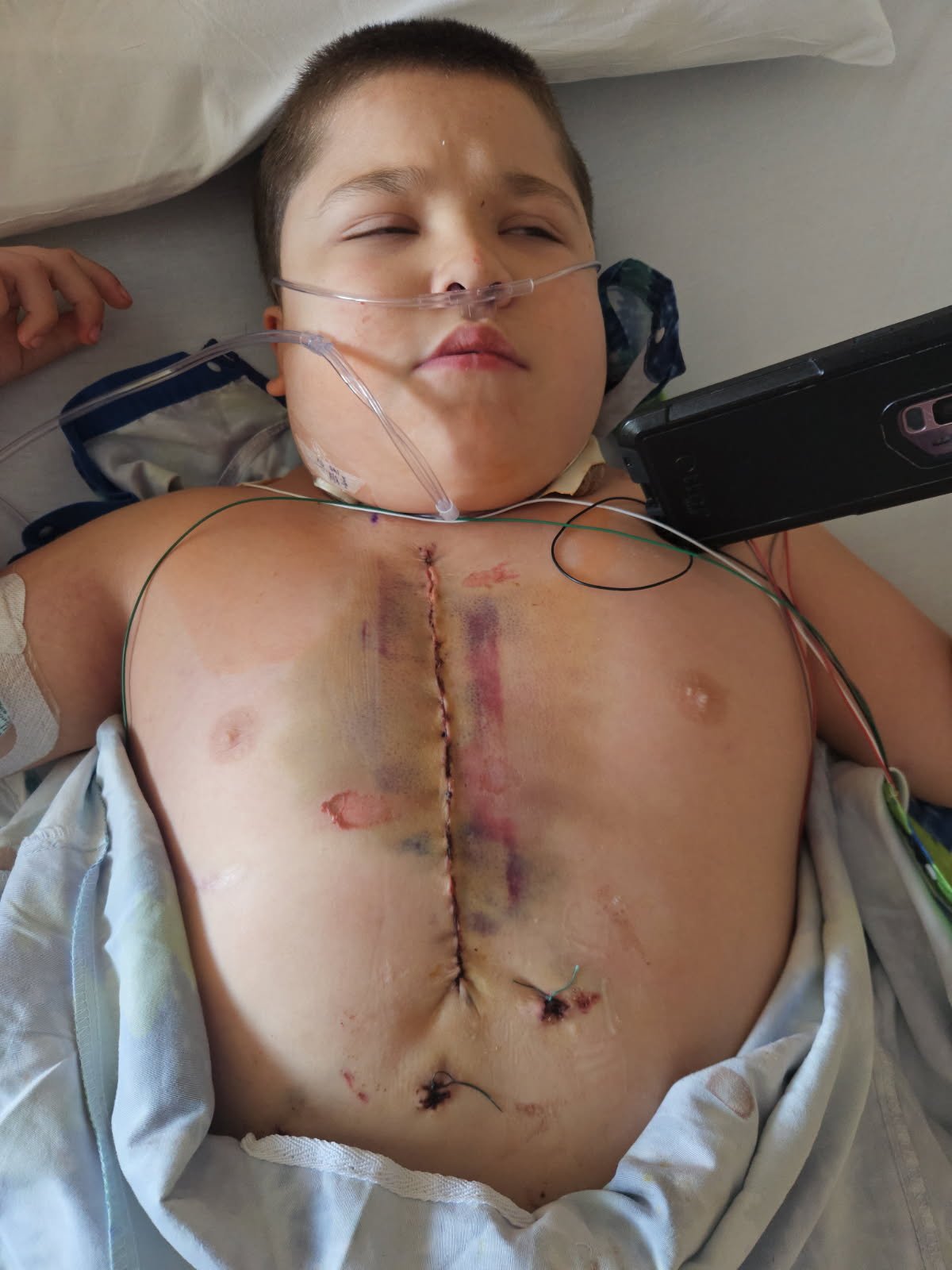 Help RJ’s Family After Heart Transplant campaign photo, 2 of 4