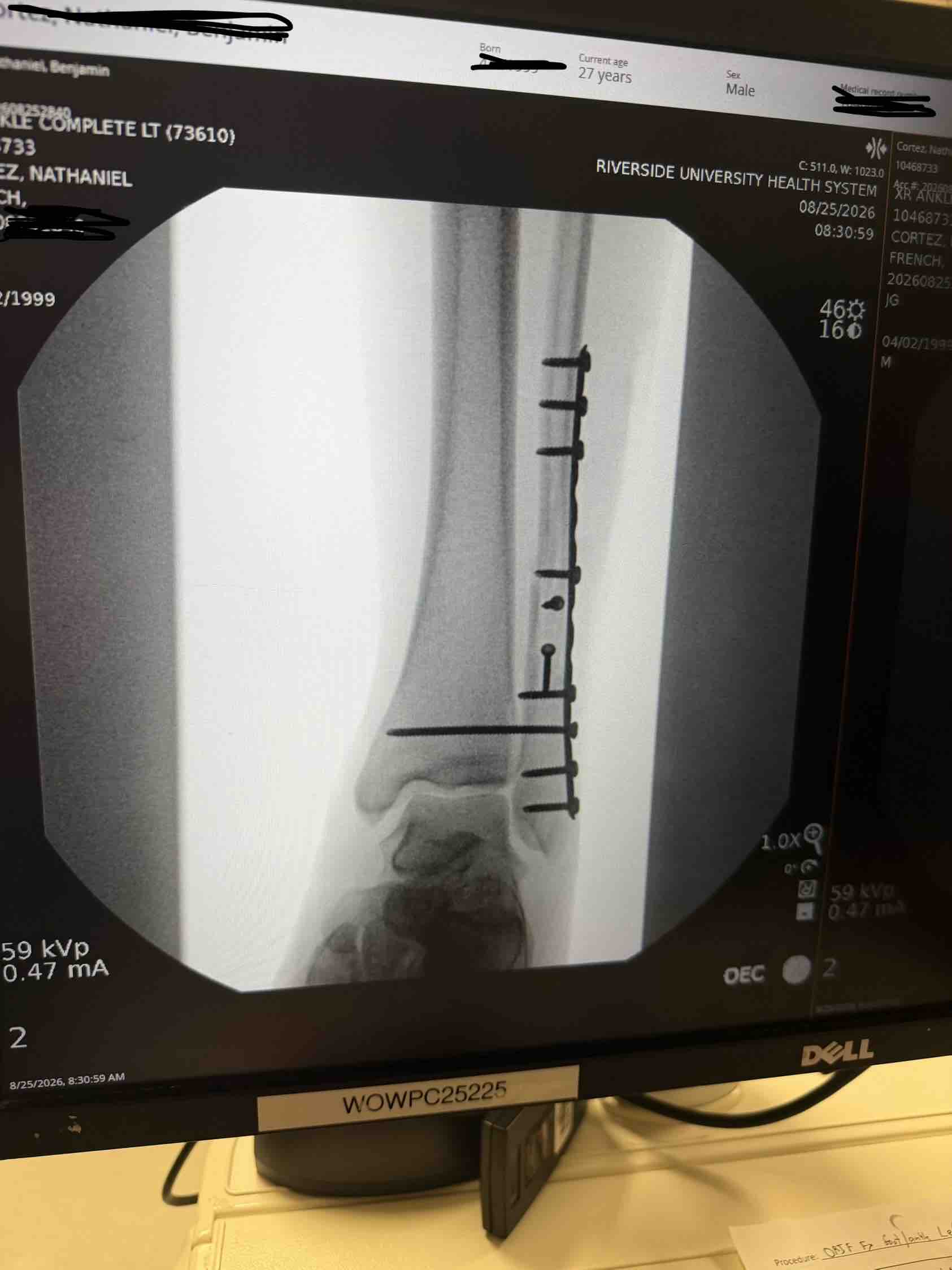 Support Nate’s Recovery After Sturgis Injury campaign photo, 5 of 7