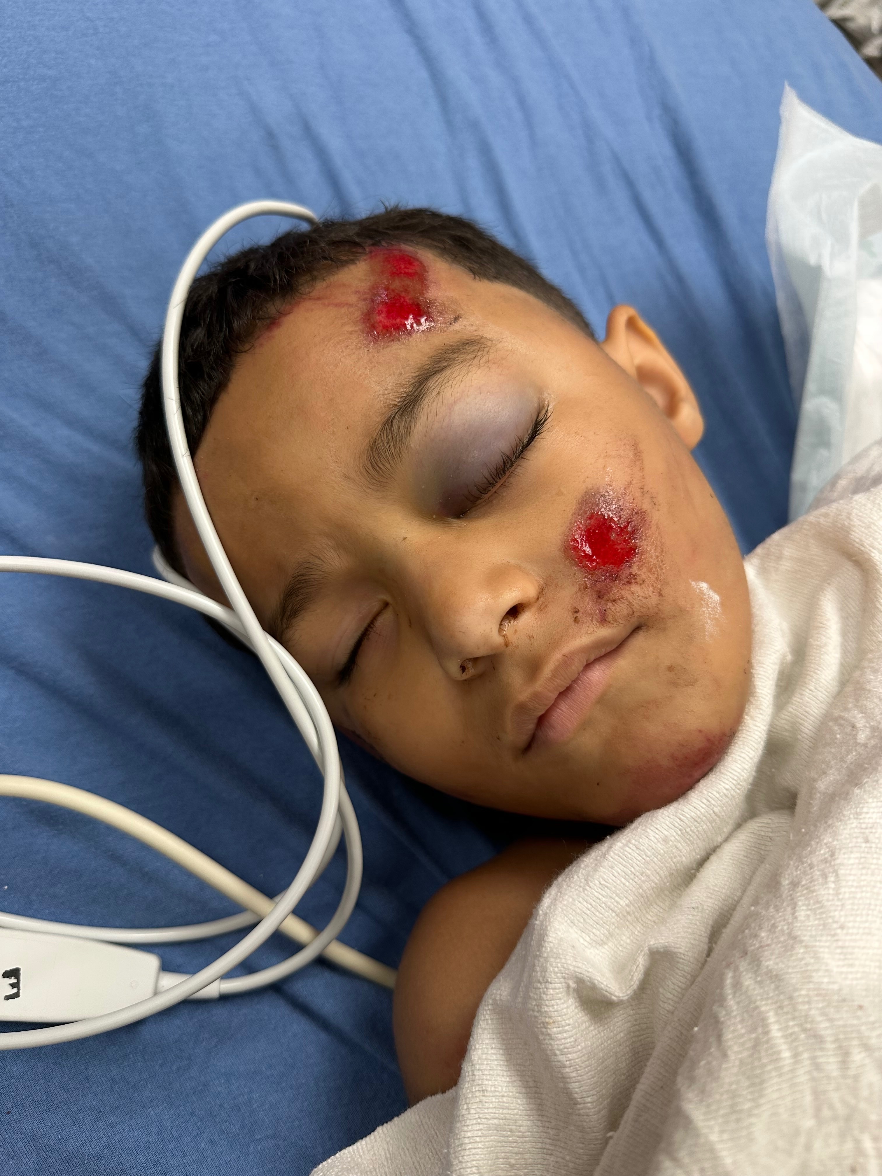 Helping support Carson’s recovery campaign photo, 2 of 6