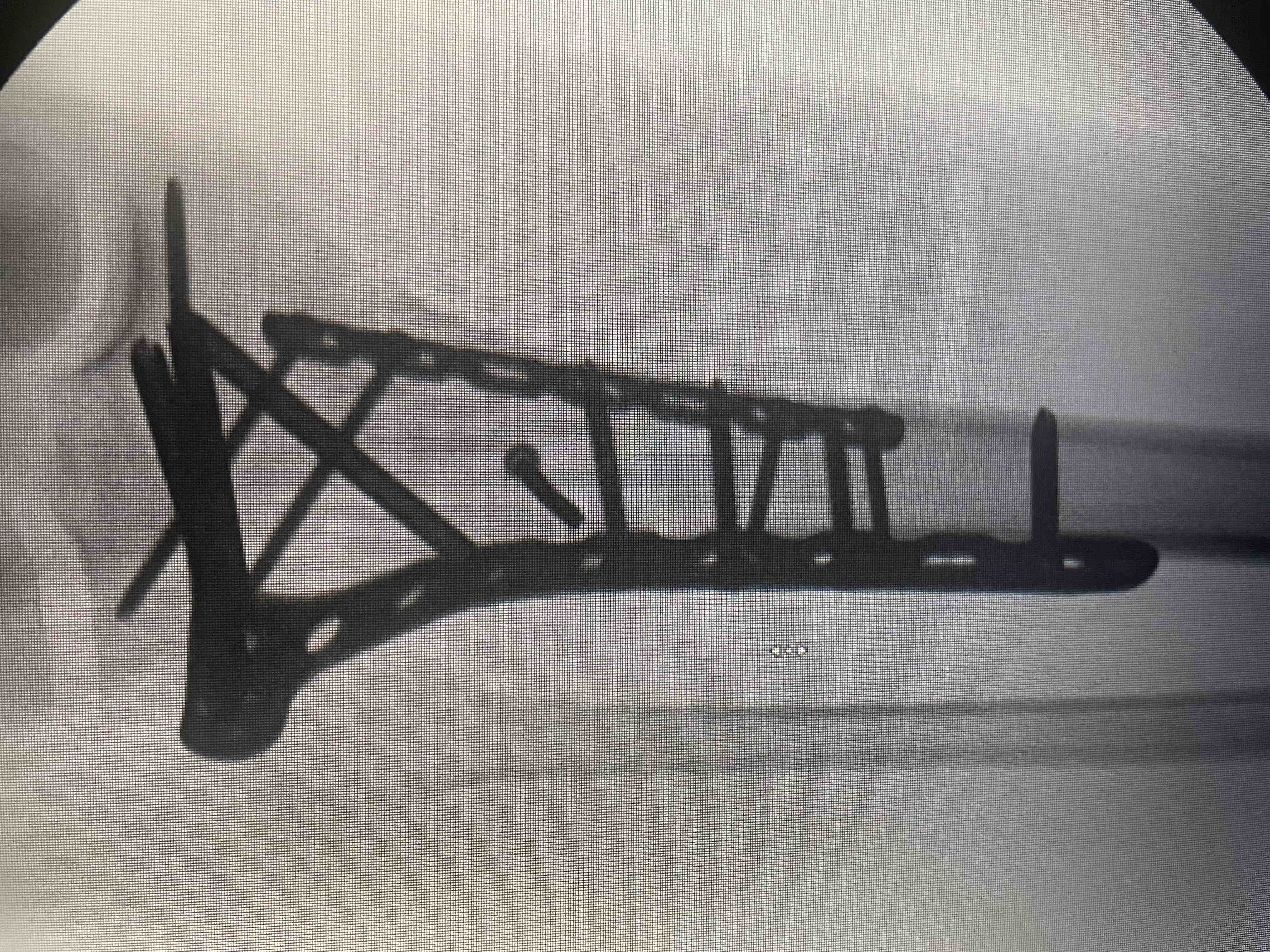 Support Shelby’s Recovery After Surgery campaign photo, 4 of 9