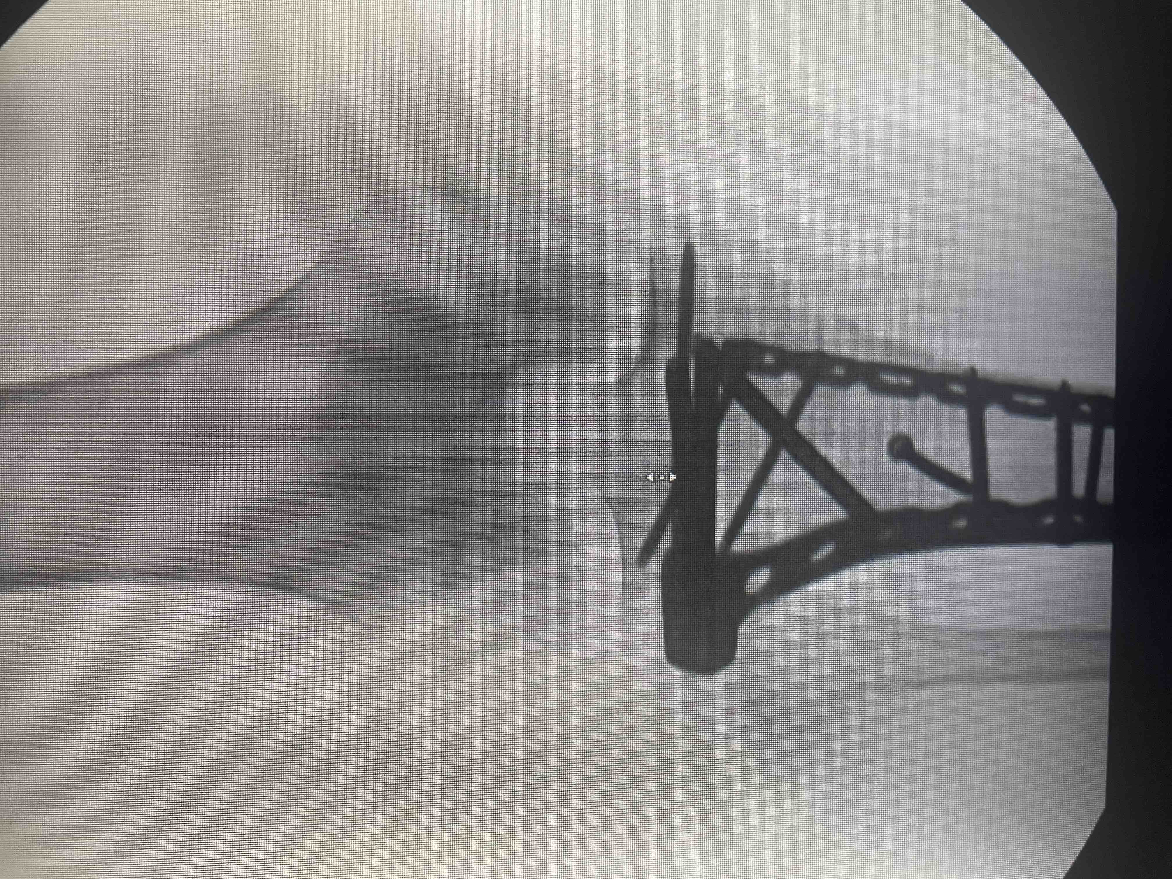 Support Shelby’s Recovery After Surgery campaign photo, 5 of 9