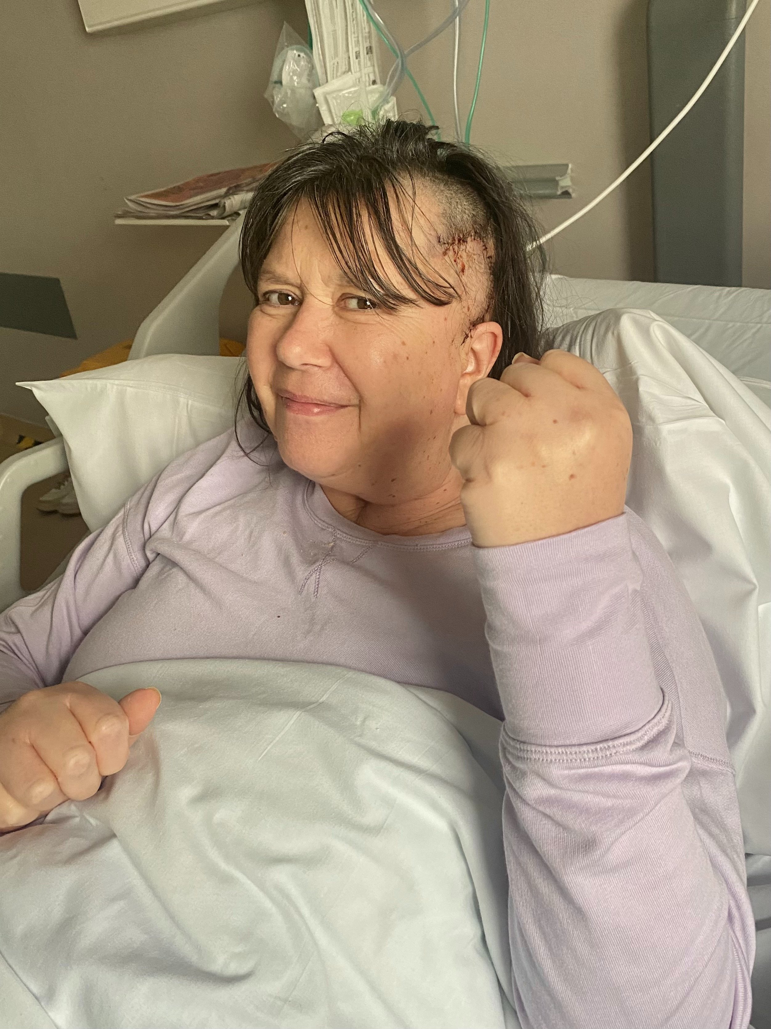 My Tour de 4 2026 Fundraiser to fight Brain Tumours campaign photo, 5 of 6