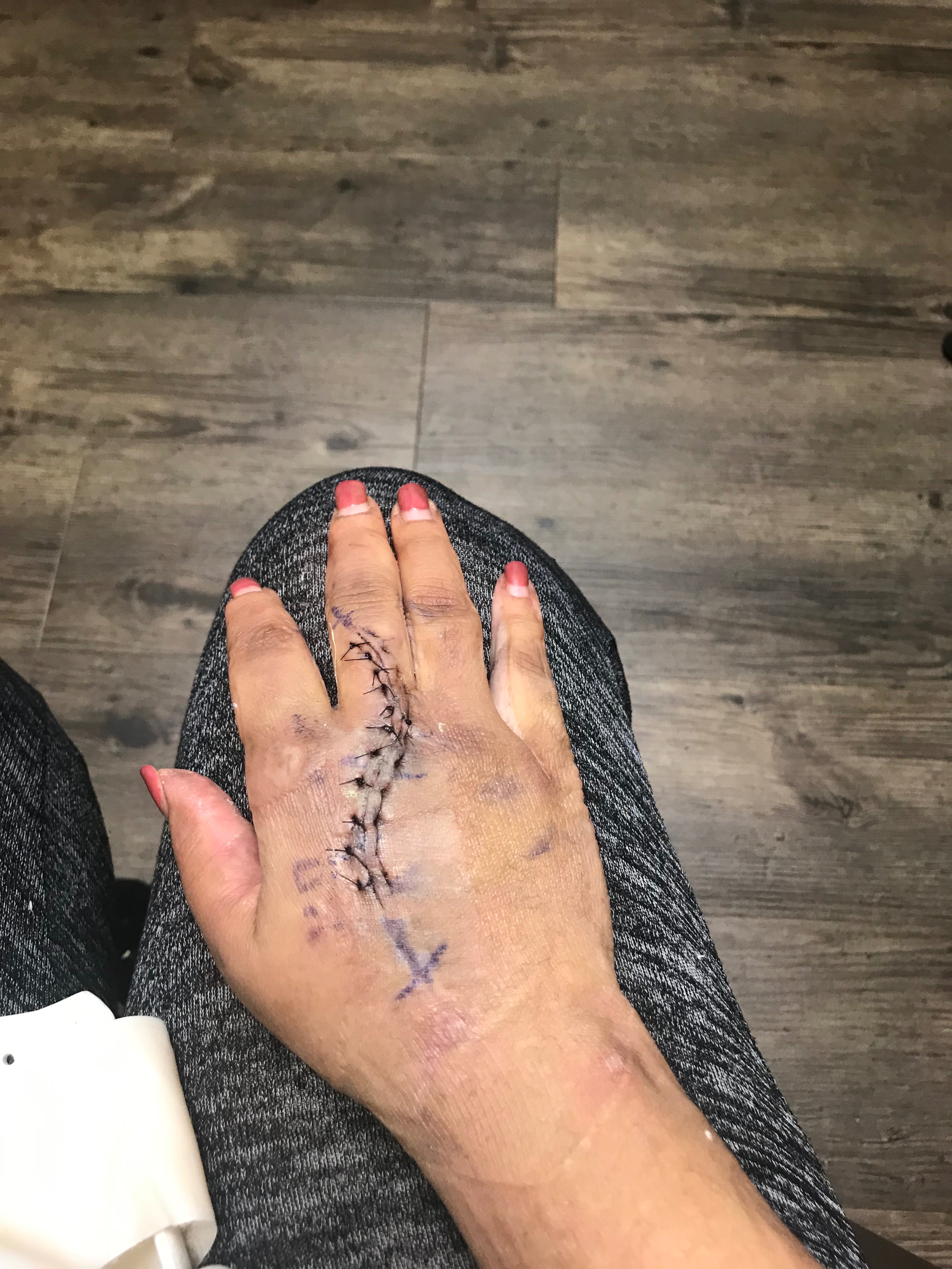 Help Luz Get Stem Cell Treatment in México campaign photo, 5 of 8
