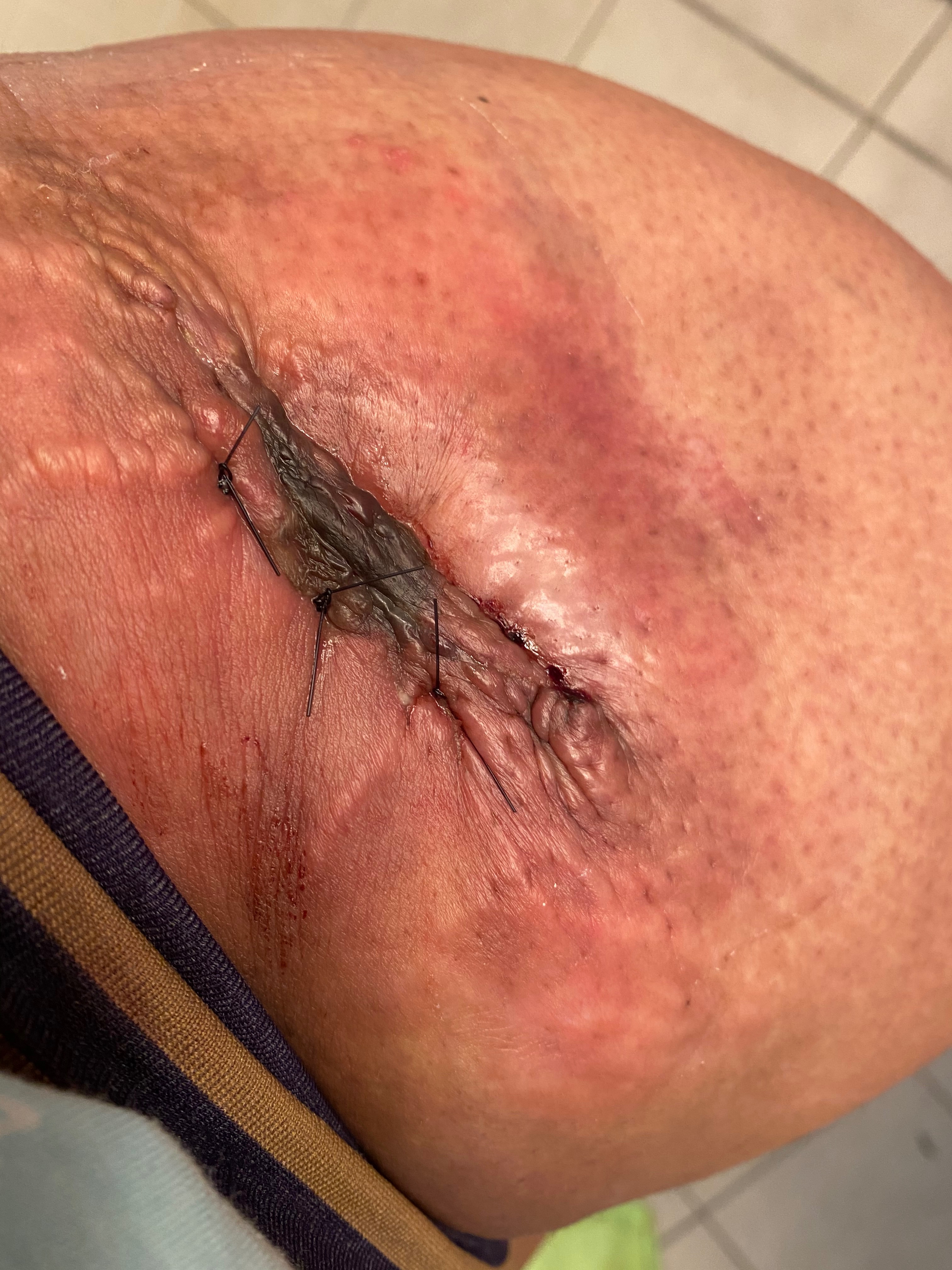 Help Luz Get Stem Cell Treatment in México campaign photo, 6 of 8