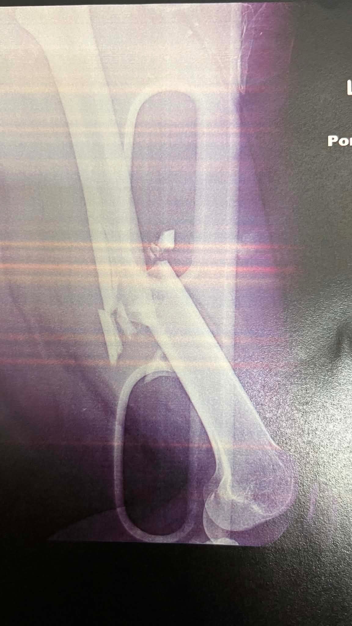 Support Sammy’s Healing Journey campaign photo, 4 of 8