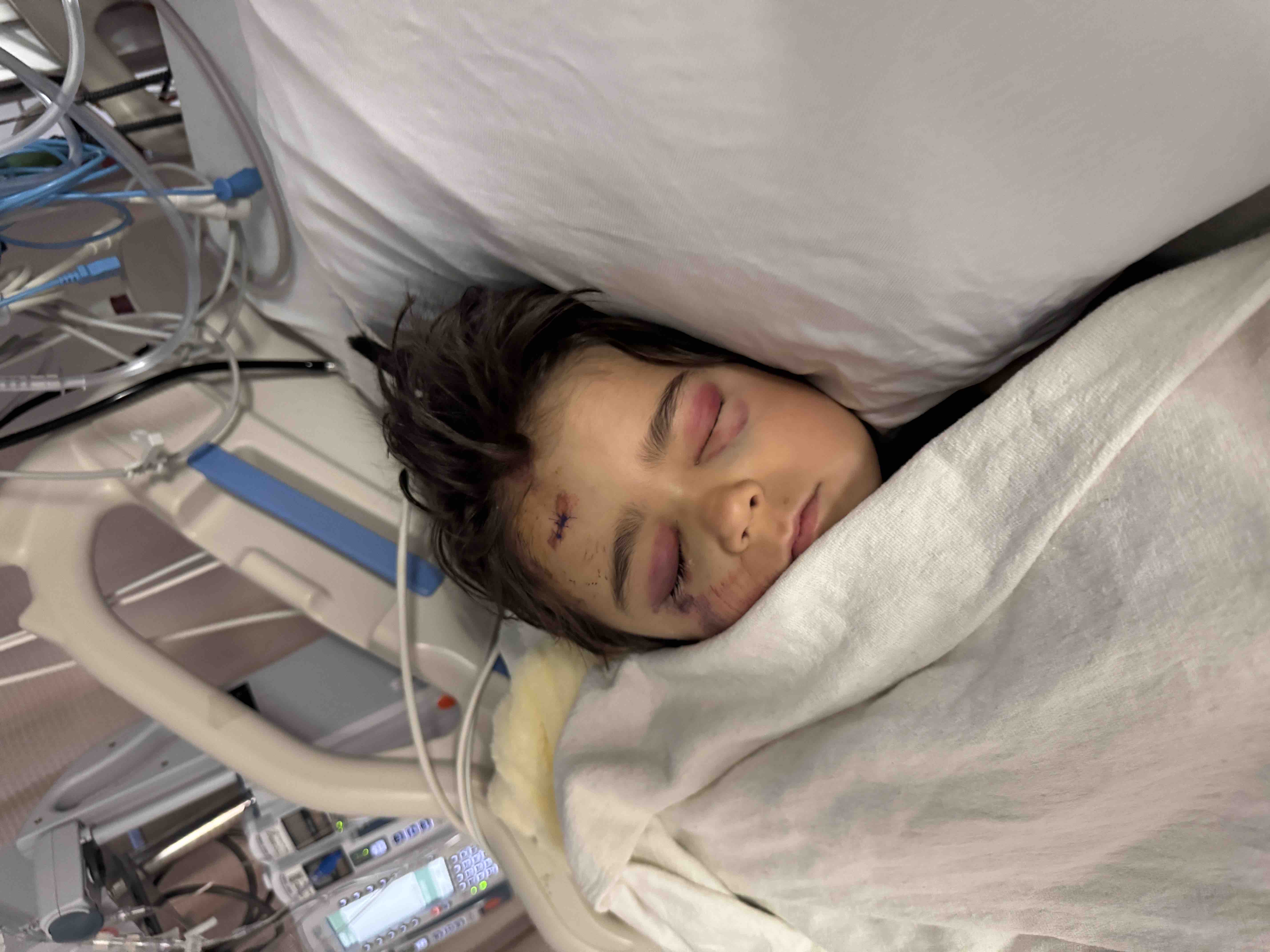 Support Zion's Recovery After His Fall campaign photo, 4 of 9