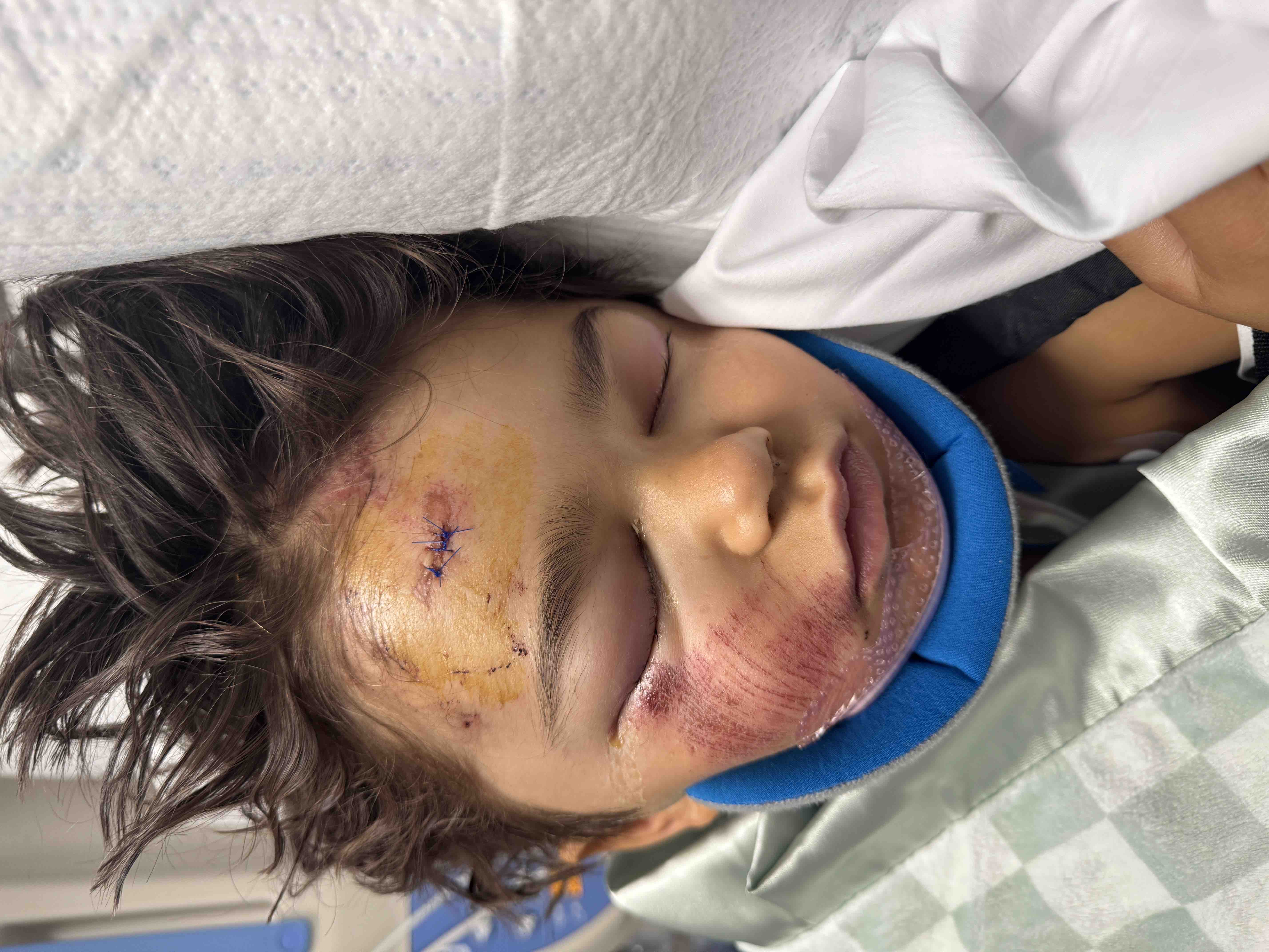 Support Zion's Recovery After His Fall campaign photo, 5 of 9