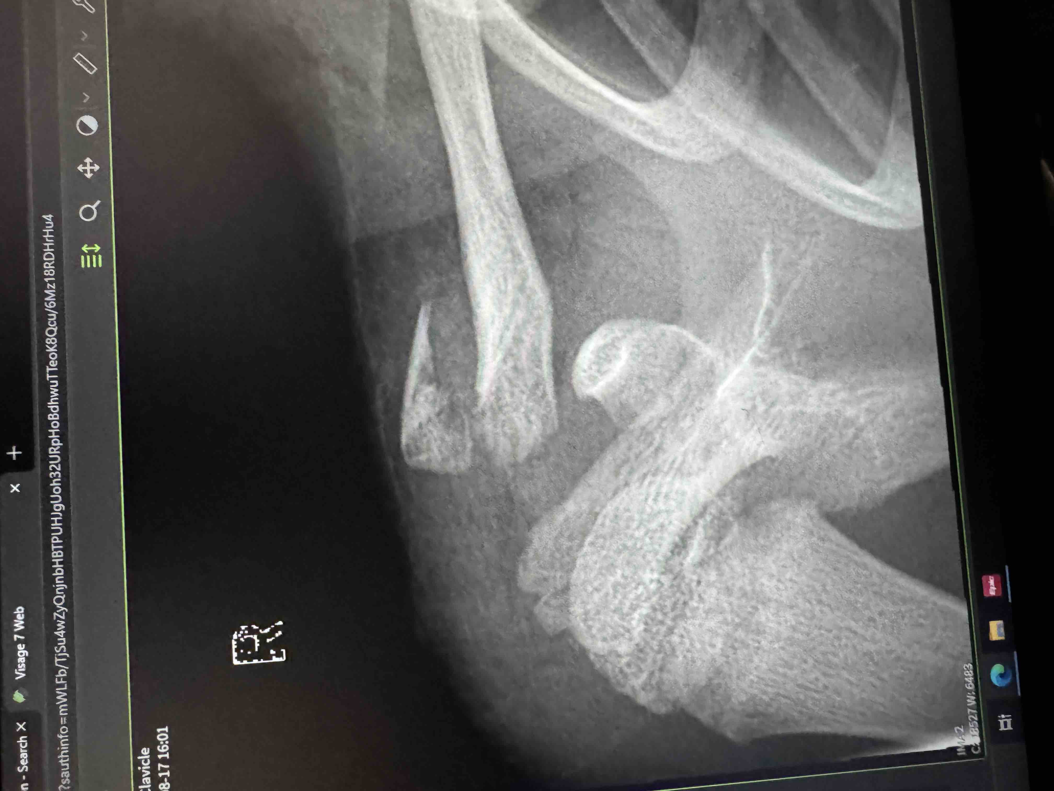 Support Zion's Recovery After His Fall campaign photo, 7 of 9