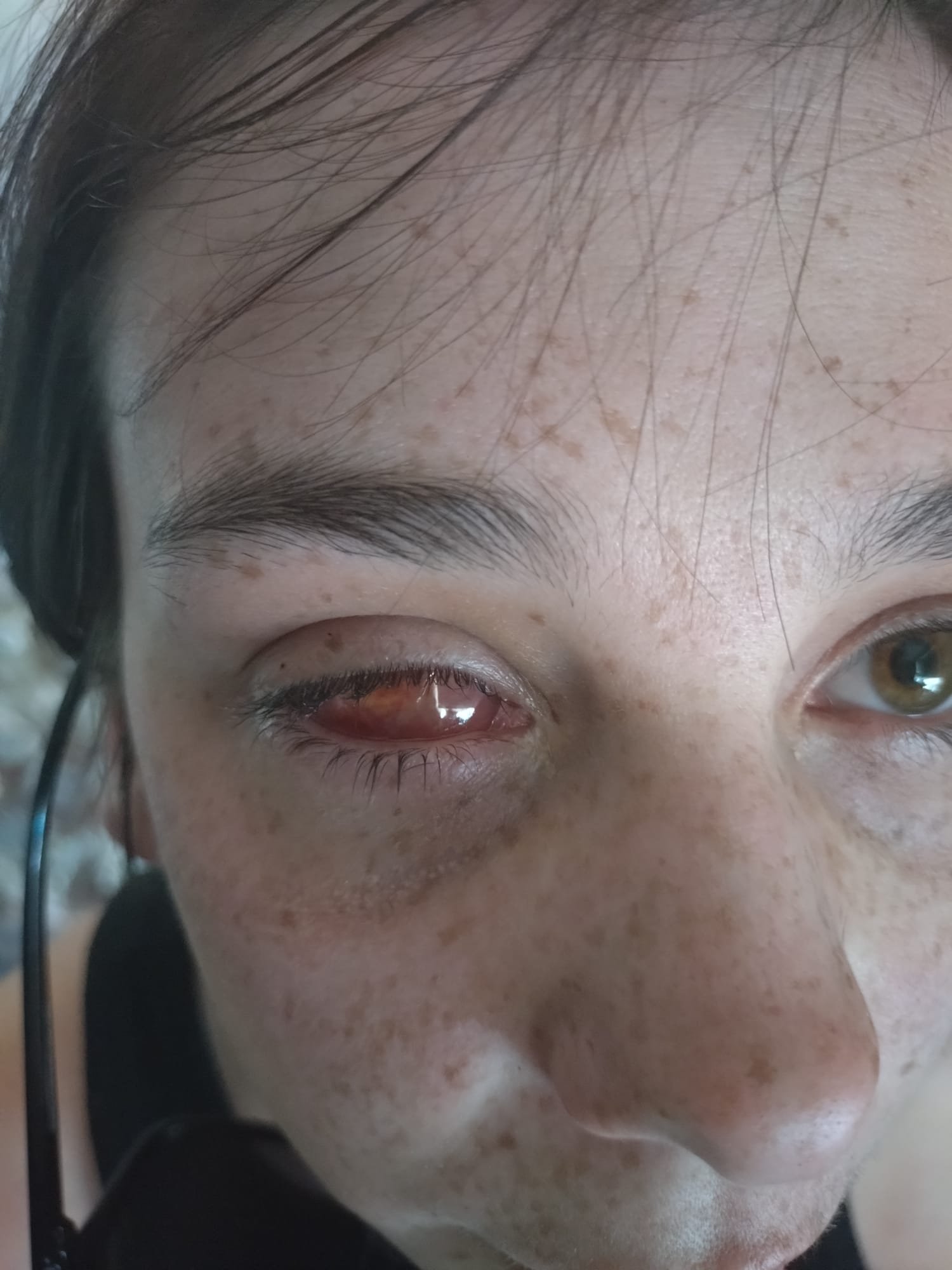 BUY ME PROSTHETIC EYES! campaign photo, 4 of 7