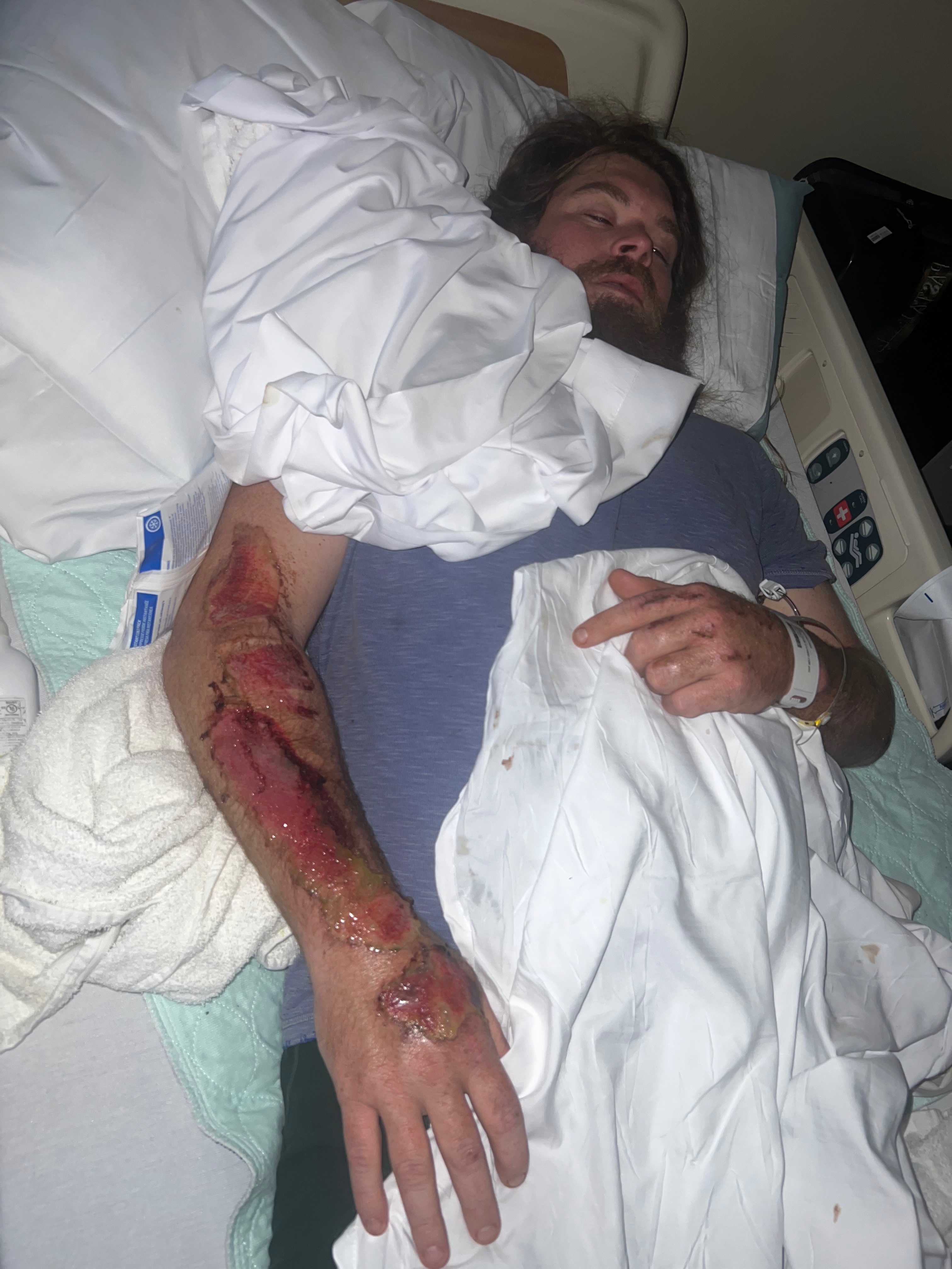 Help Colton and Our Growing Family Through Recovery campaign photo, 2 of 7