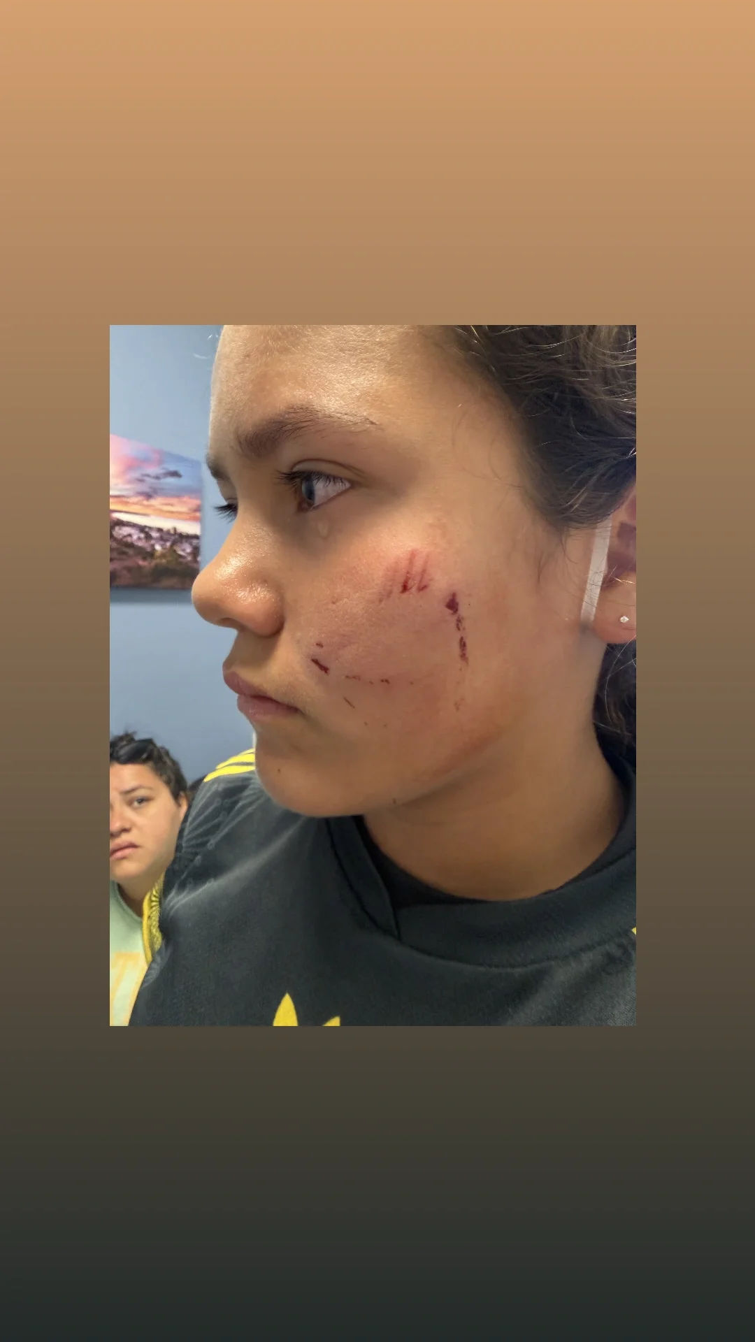 Help Kailie and Her Dogs Recover campaign photo, 4 of 5