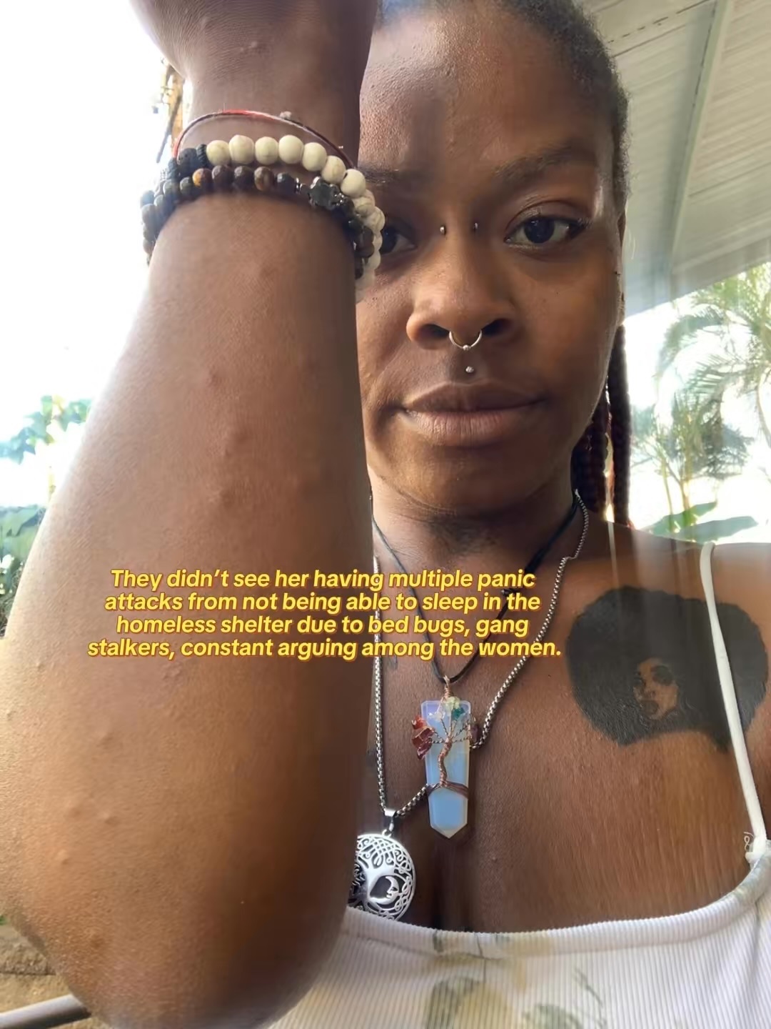 Help Catherine Stay Housed and Heal campaign photo, 2 of 5
