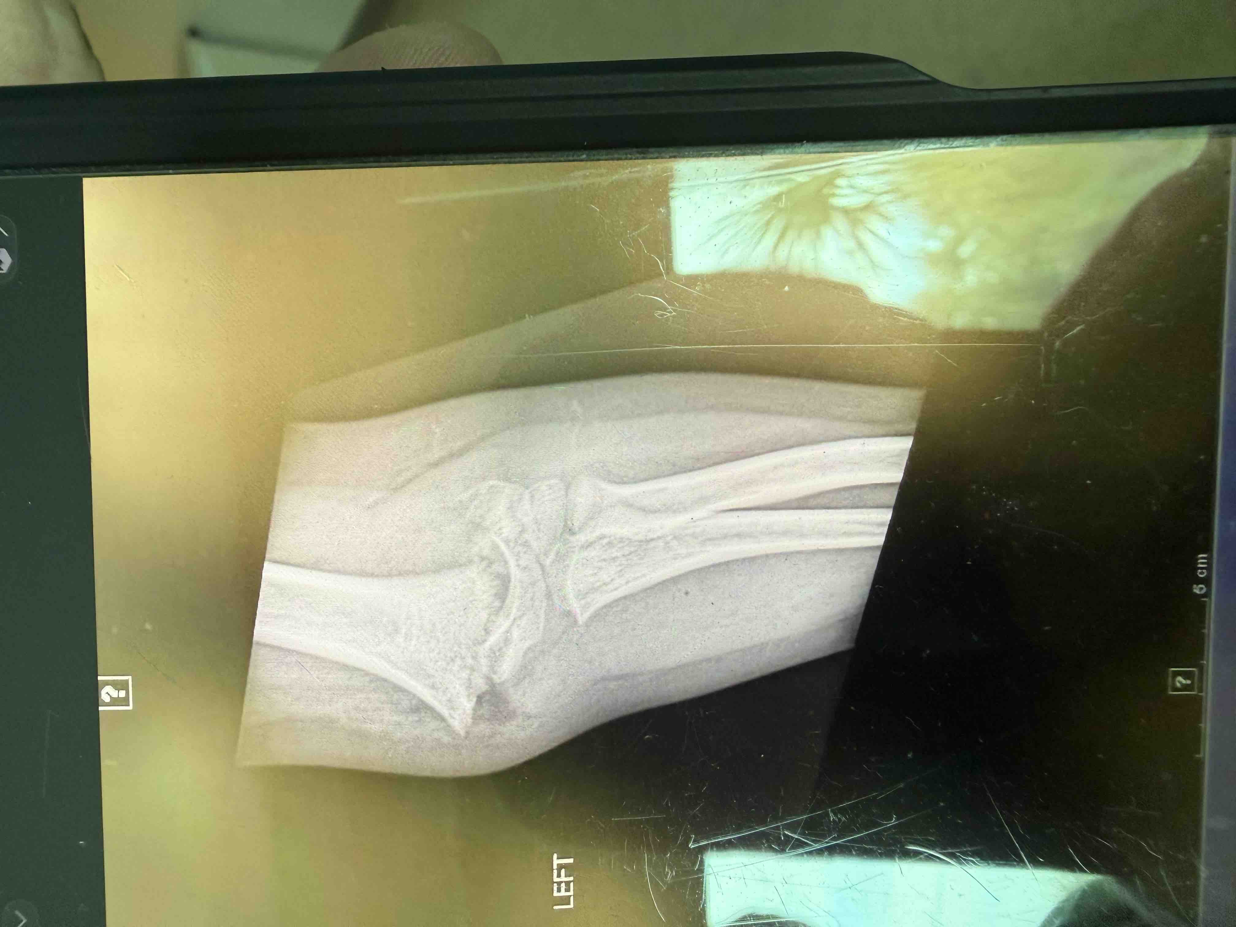 Help Rosie Heal After Surgery campaign photo, 5 of 9