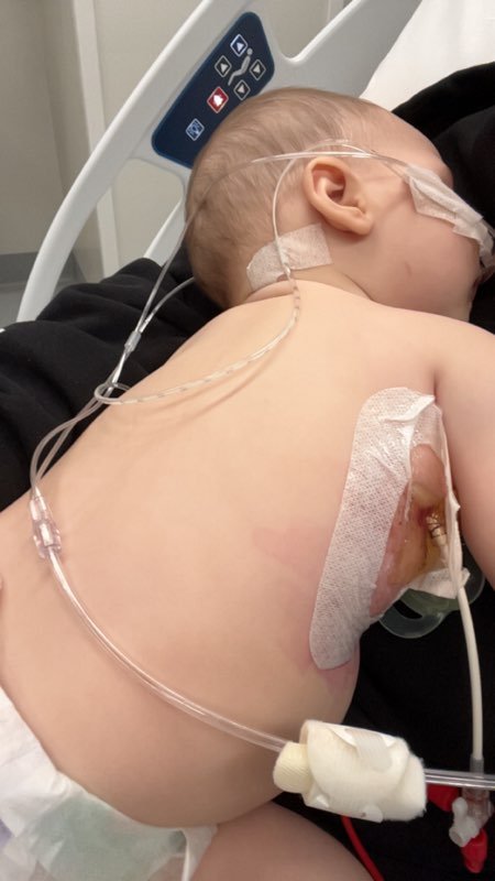 Help Harlin Fight a One-in-a-Million Childhood Cancer campaign photo, 4 of 7
