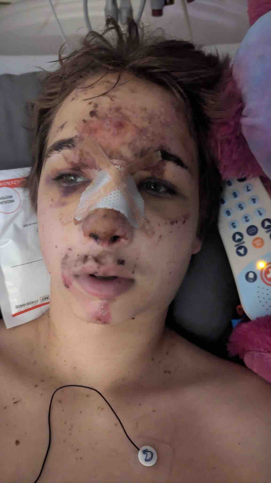 14 year old boy hit in Roy, Utah. Needs HELP! campaign photo, 2 of 5