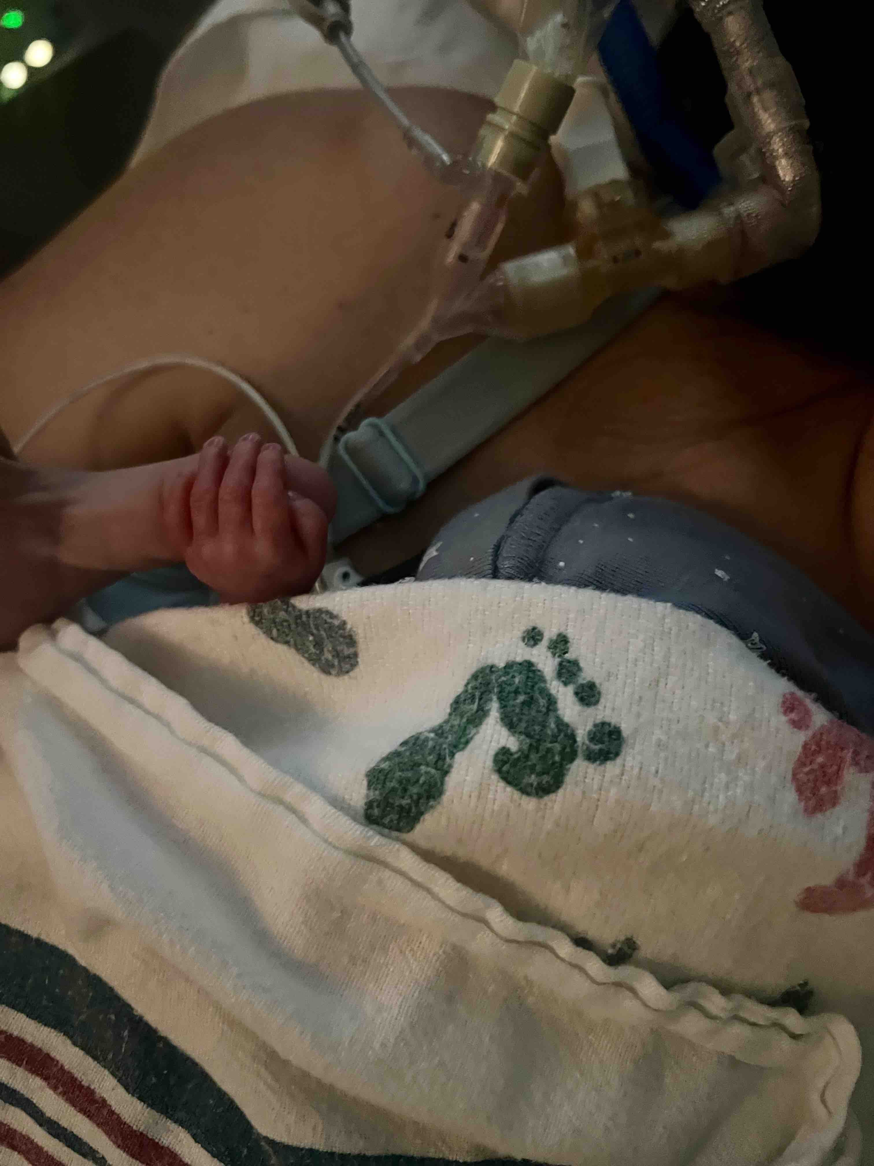 Support Our Family Through NICU Months campaign photo, 6 of 12