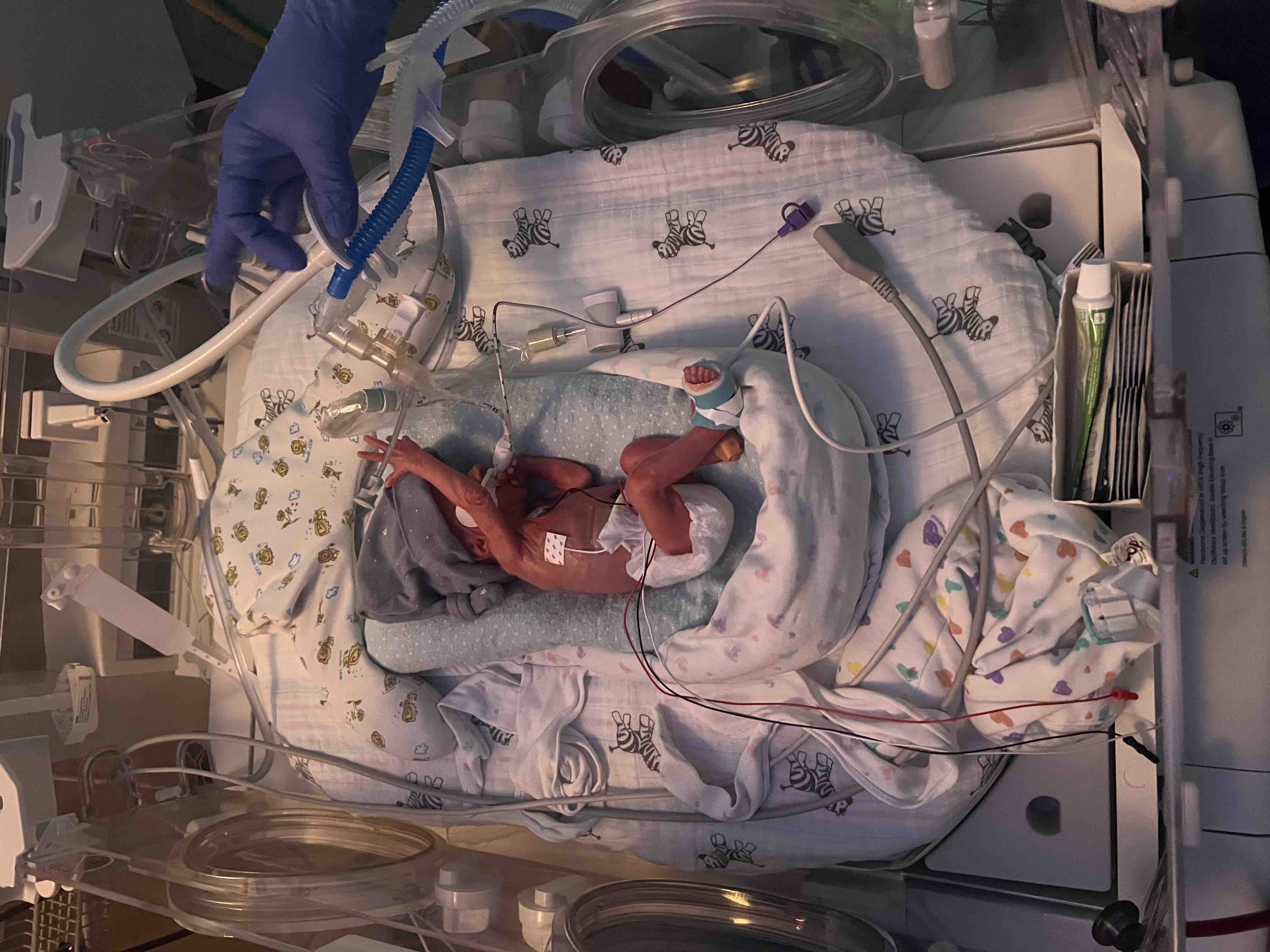 Support Our Family Through NICU Months campaign photo, 7 of 12