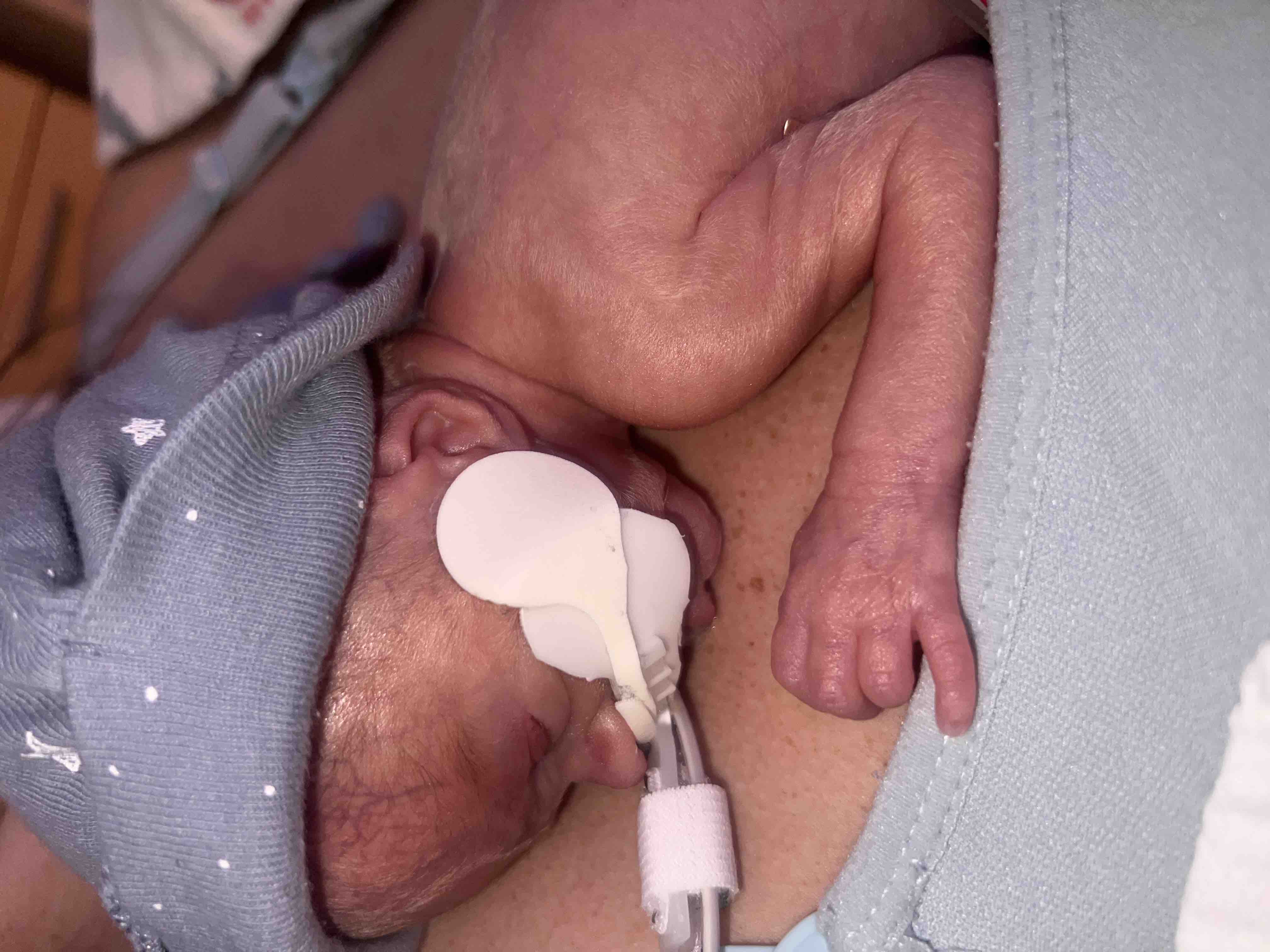Support Our Family Through NICU Months campaign photo, 8 of 12