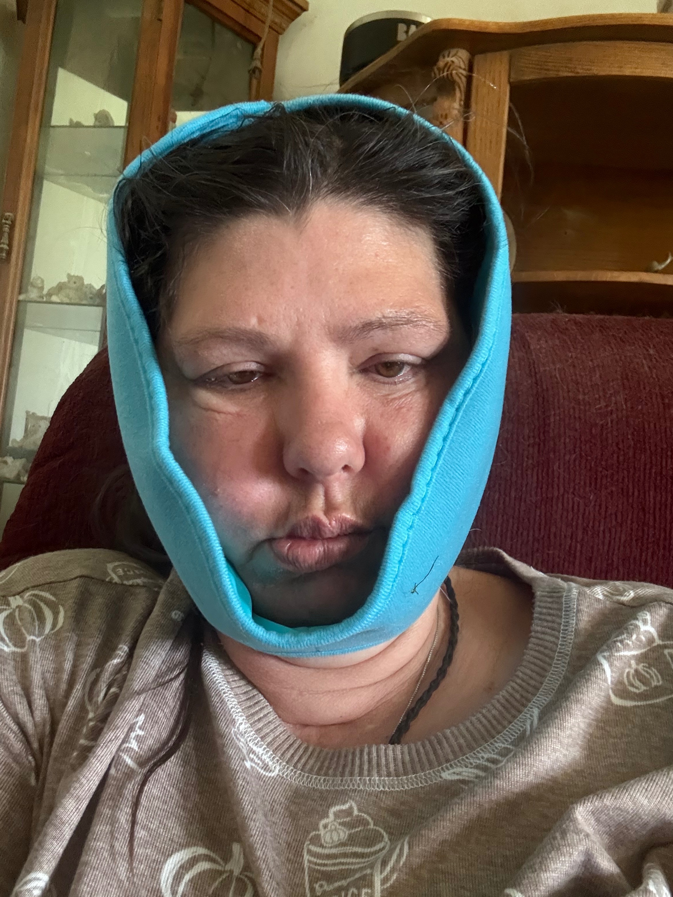 Support Kathryn's Fight to Open Her Mouth Again campaign photo, 6 of 13