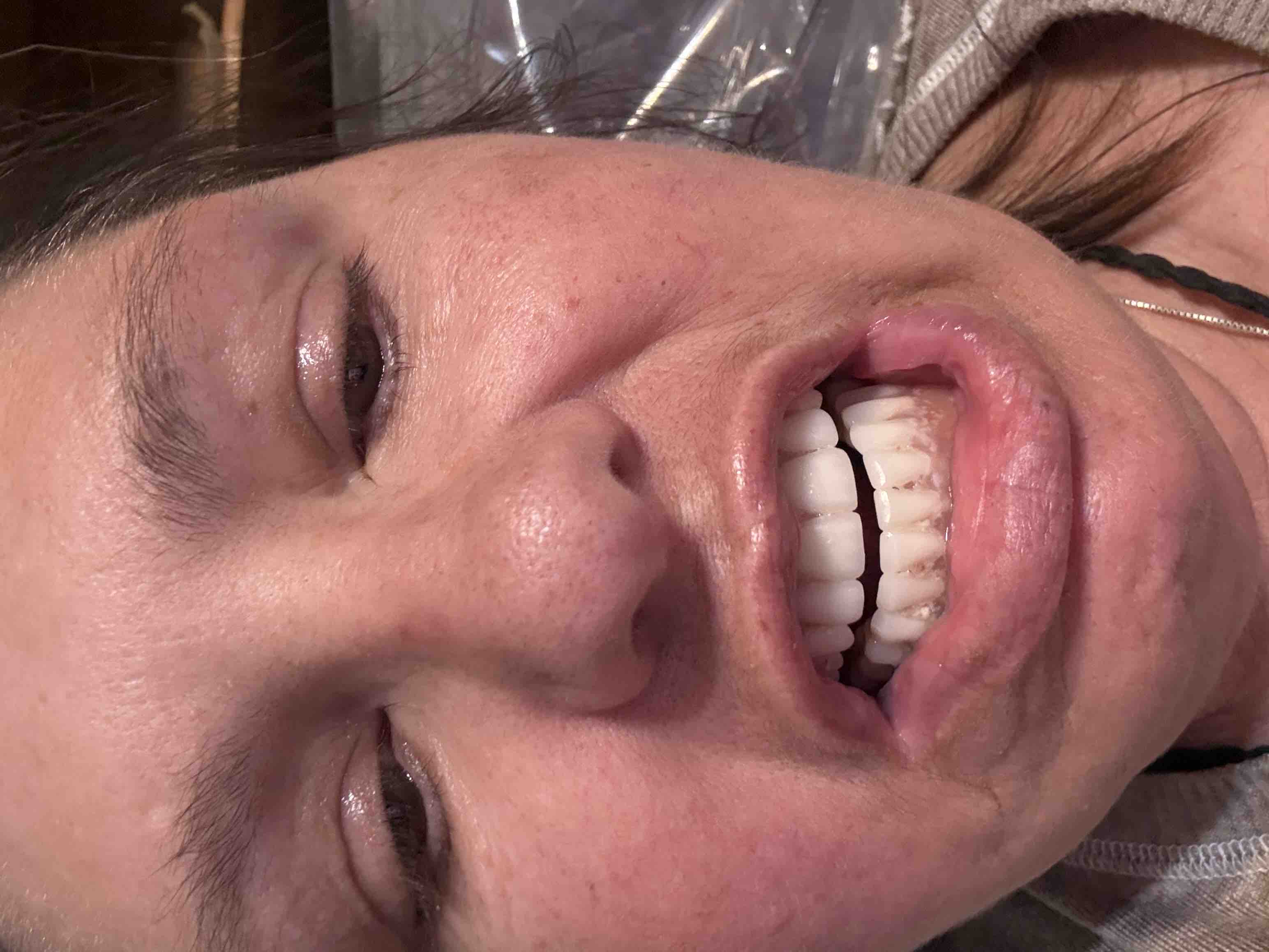 Support Kathryn's Fight to Open Her Mouth Again campaign photo, 11 of 13