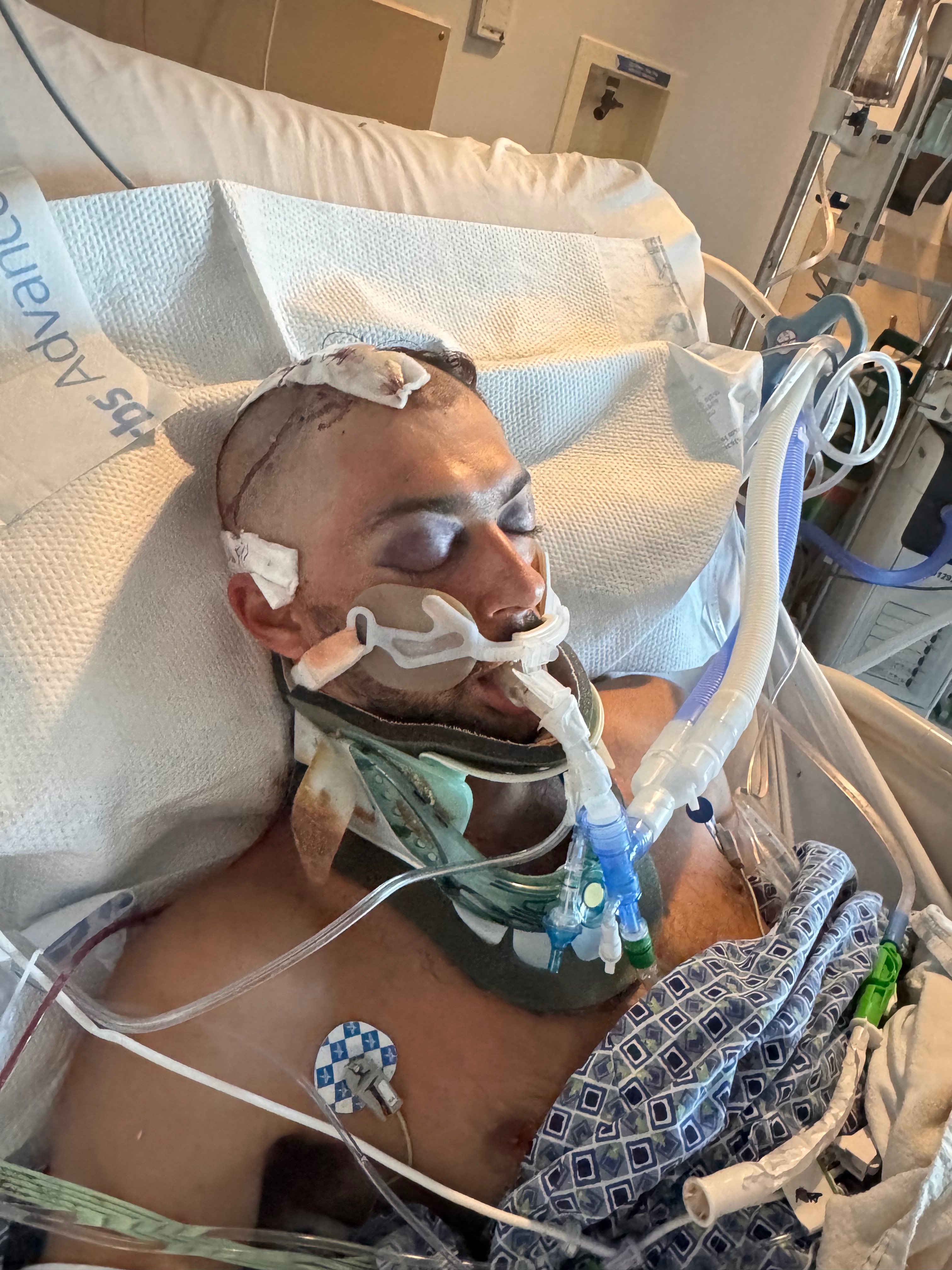 Support Chandler’s Healing Journey After E-Bike Accident campaign photo, 6 of 7