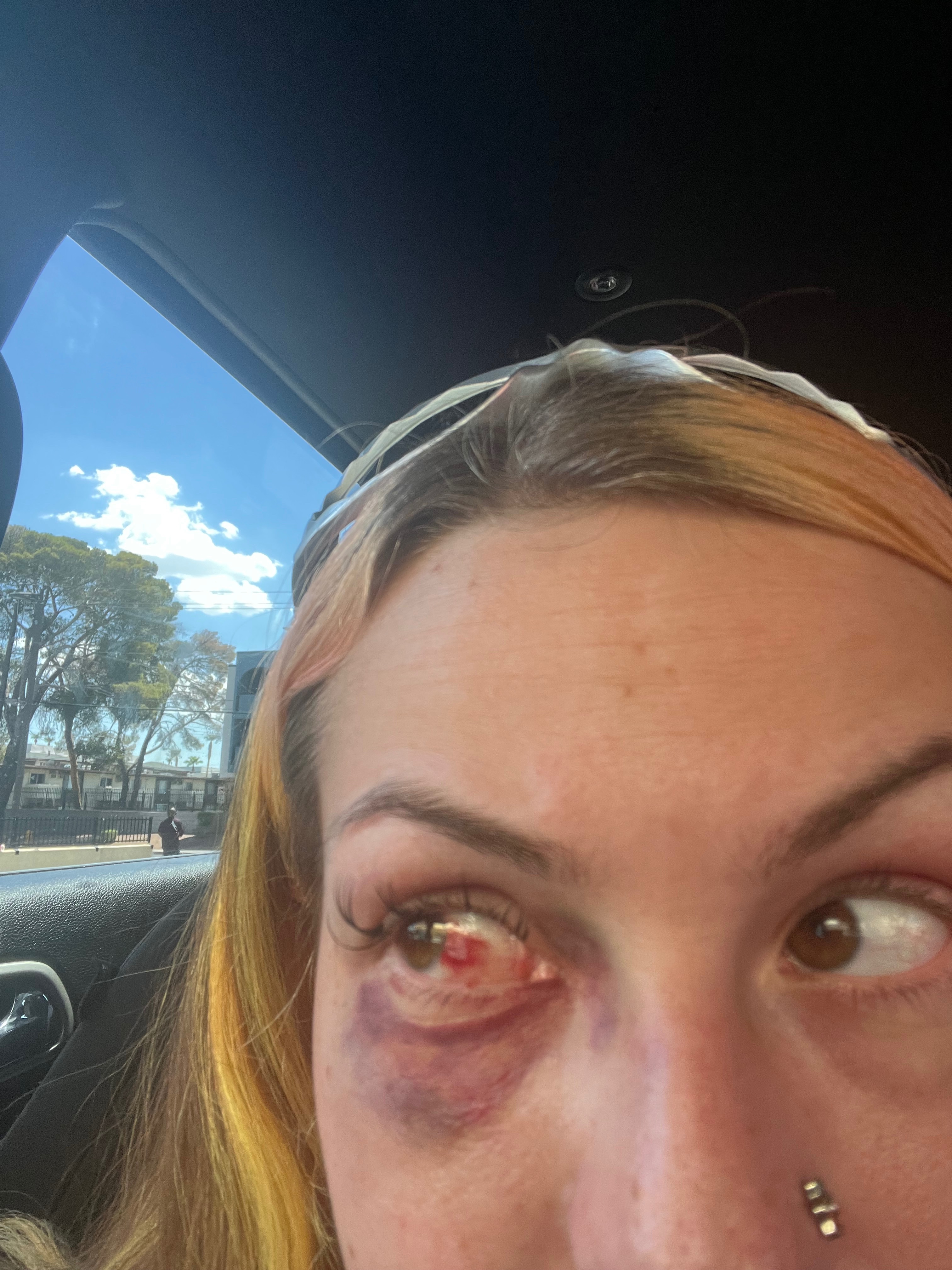 Help Pam Seek Justice on domestic violence and heal campaign photo, 2 of 8
