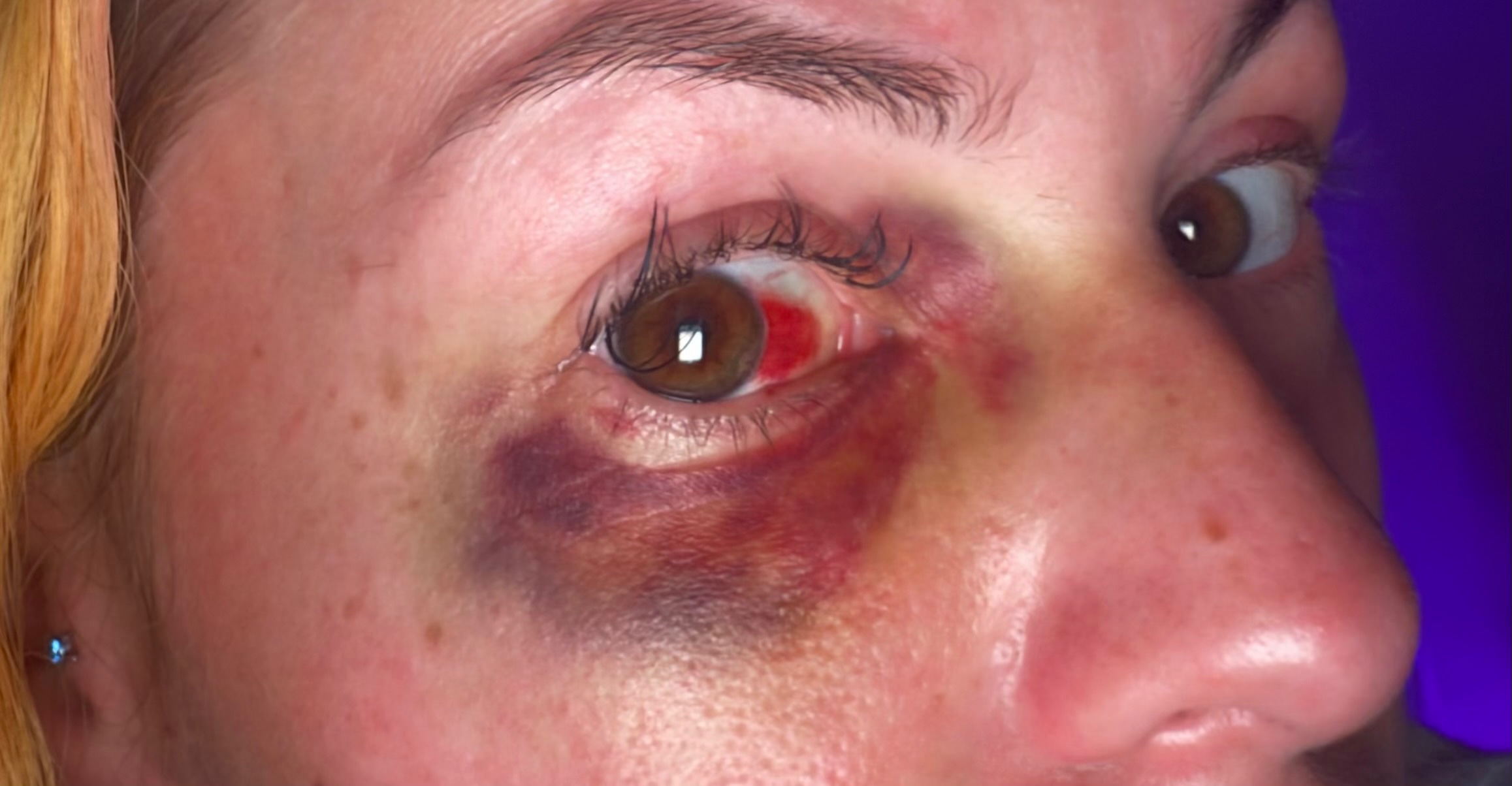 Help Pam Seek Justice on domestic violence and heal campaign photo, 6 of 8