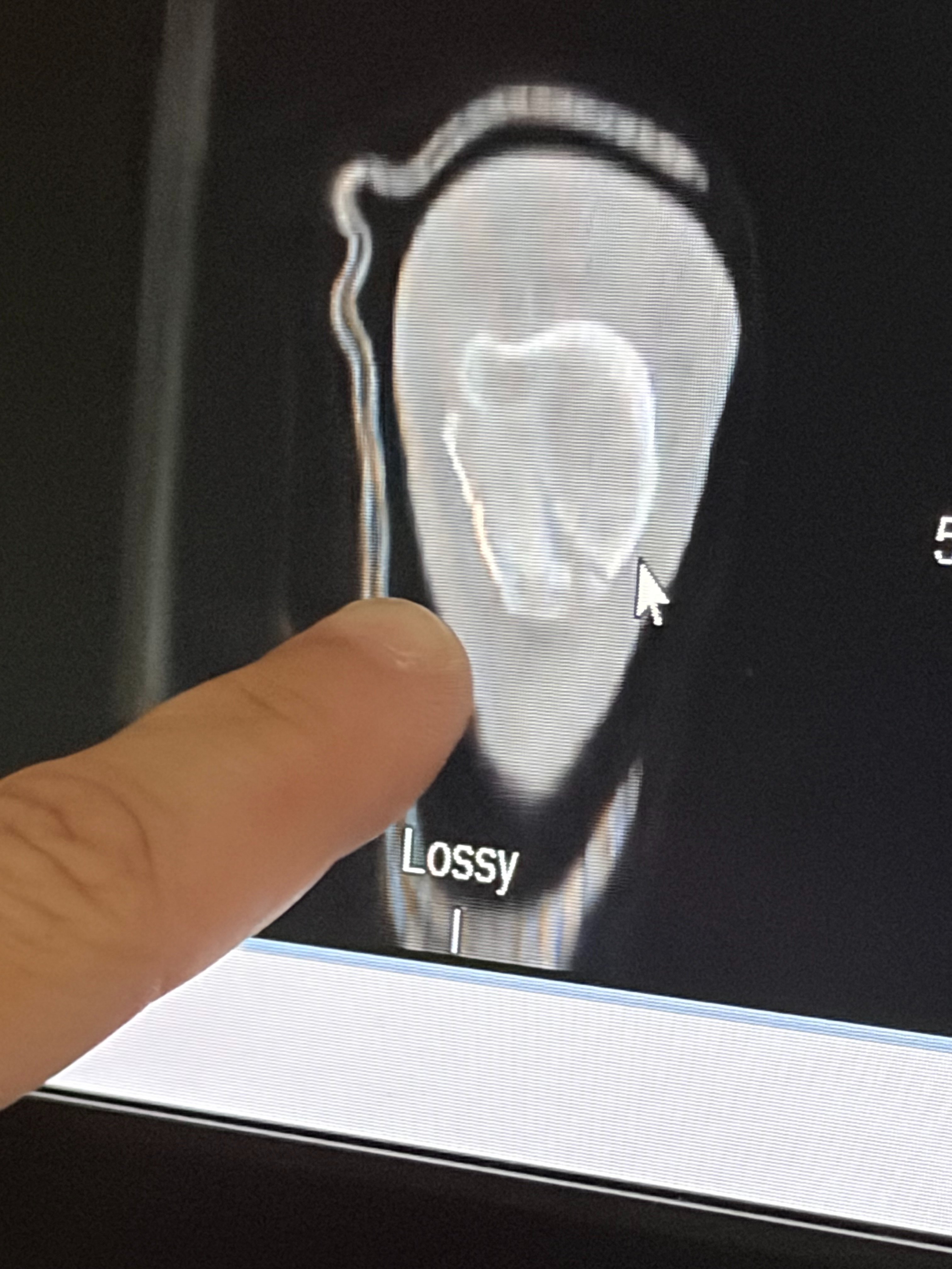 Help Josh Get Back on His Feet—Literally campaign photo, 2 of 10
