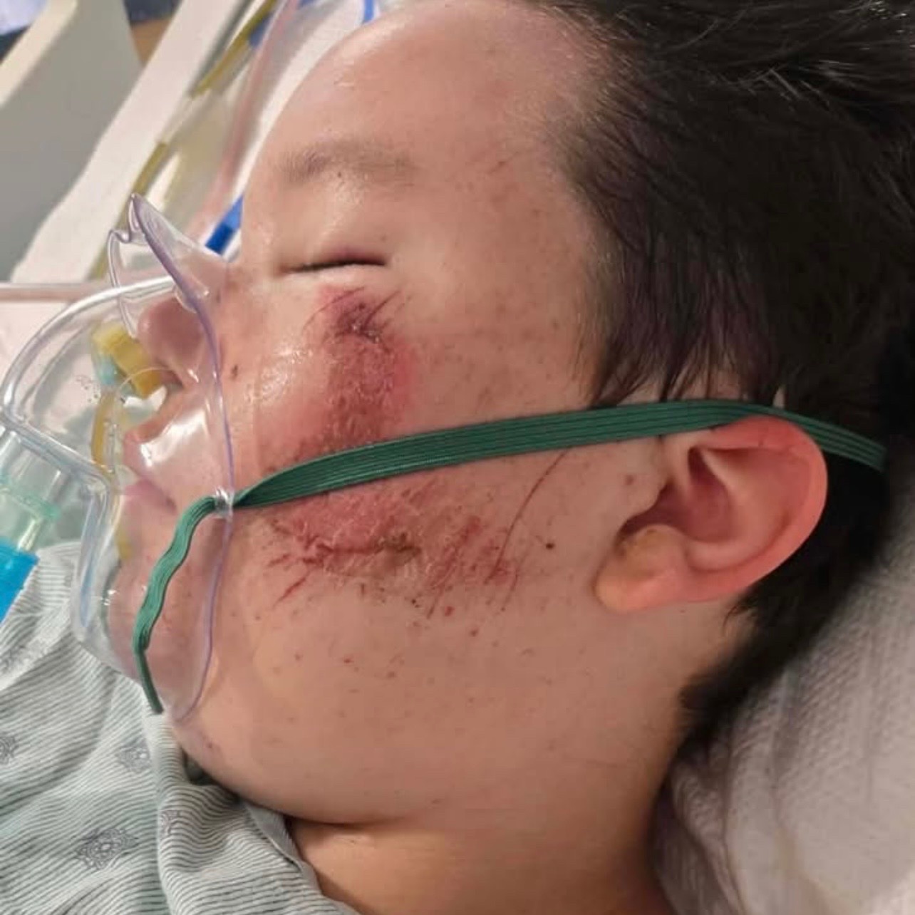 Help Evan Marling's after a deadly wrecked left him critical campaign photo, 5 of 7