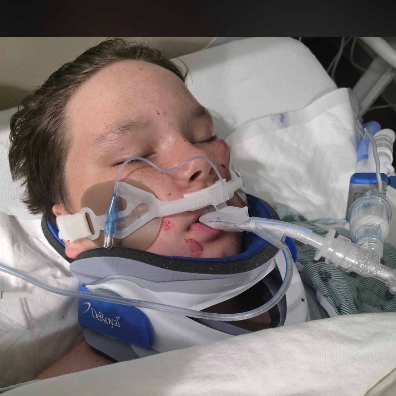 Help Evan Marling's after a deadly wrecked left him critical campaign photo, 2 of 7