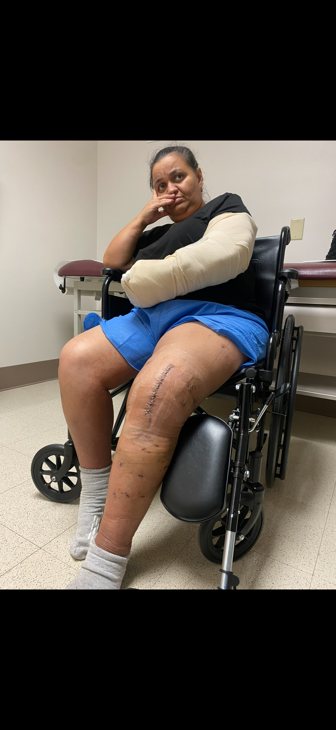 Help My Mom After a Drunk Driver Changed Her Life campaign photo, 4 of 7