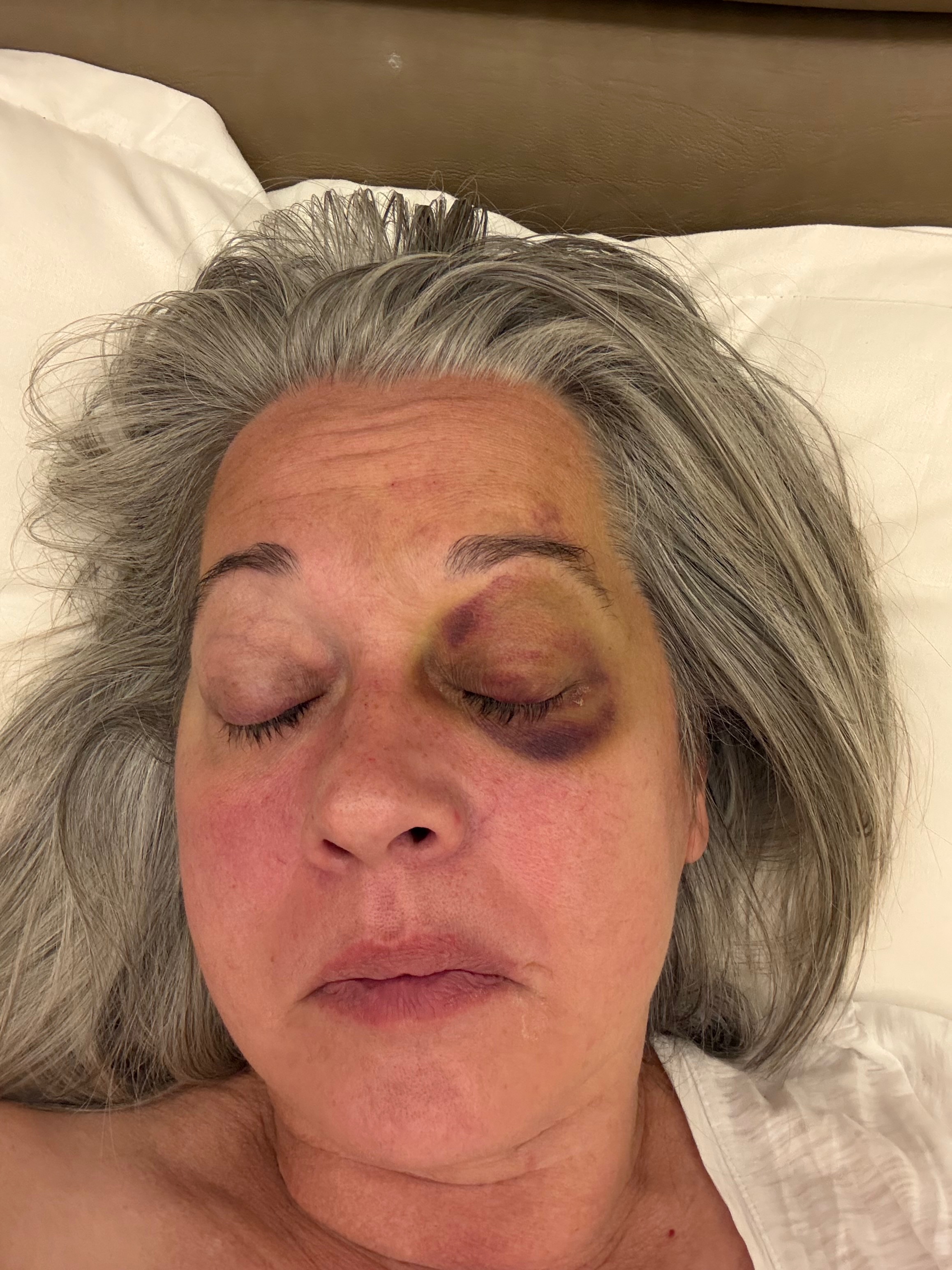 Help Lynn Through Brain Tumor Treatment campaign photo, 4 of 6
