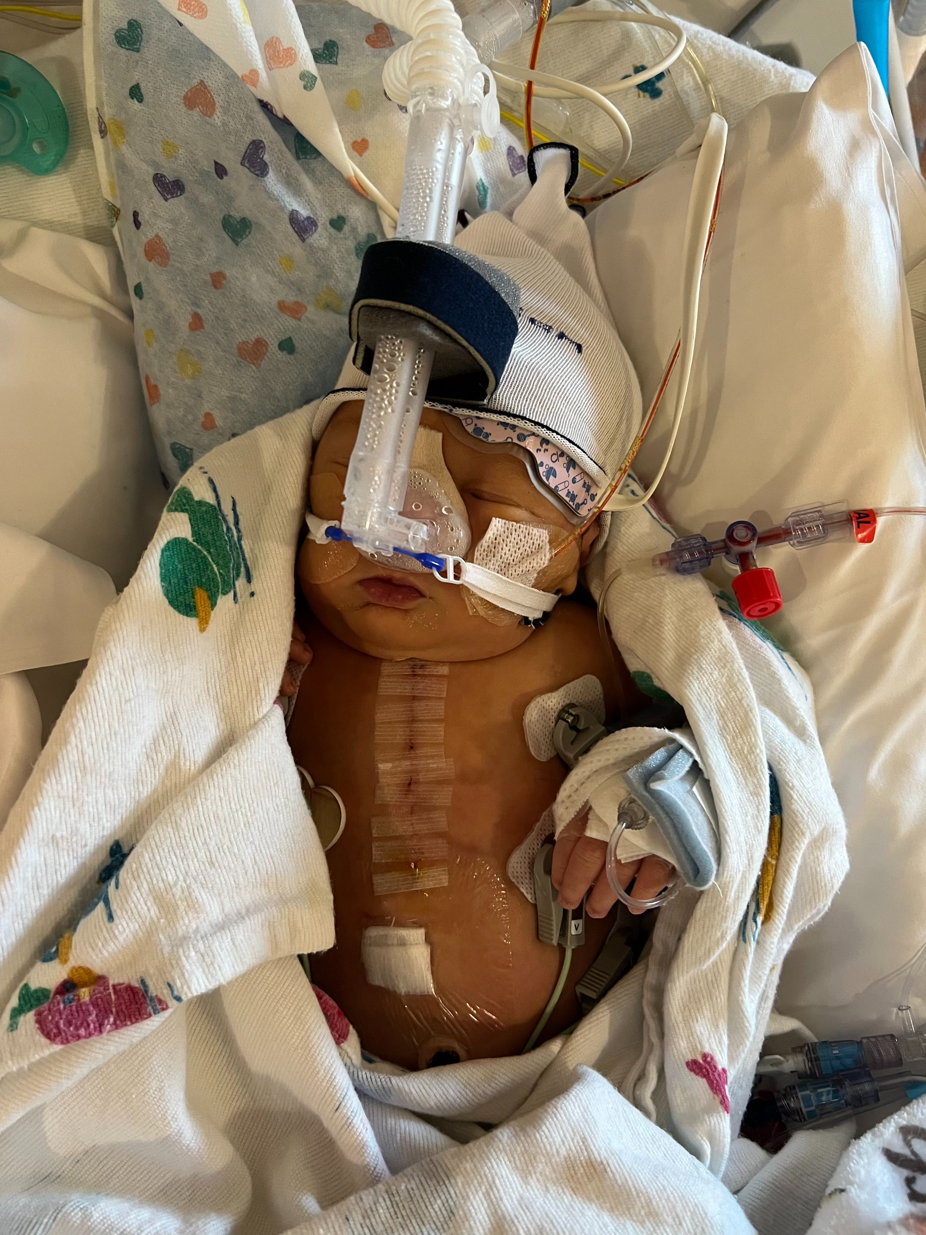 Support Connor’s Heart Surgery and Recovery campaign photo, 7 of 8